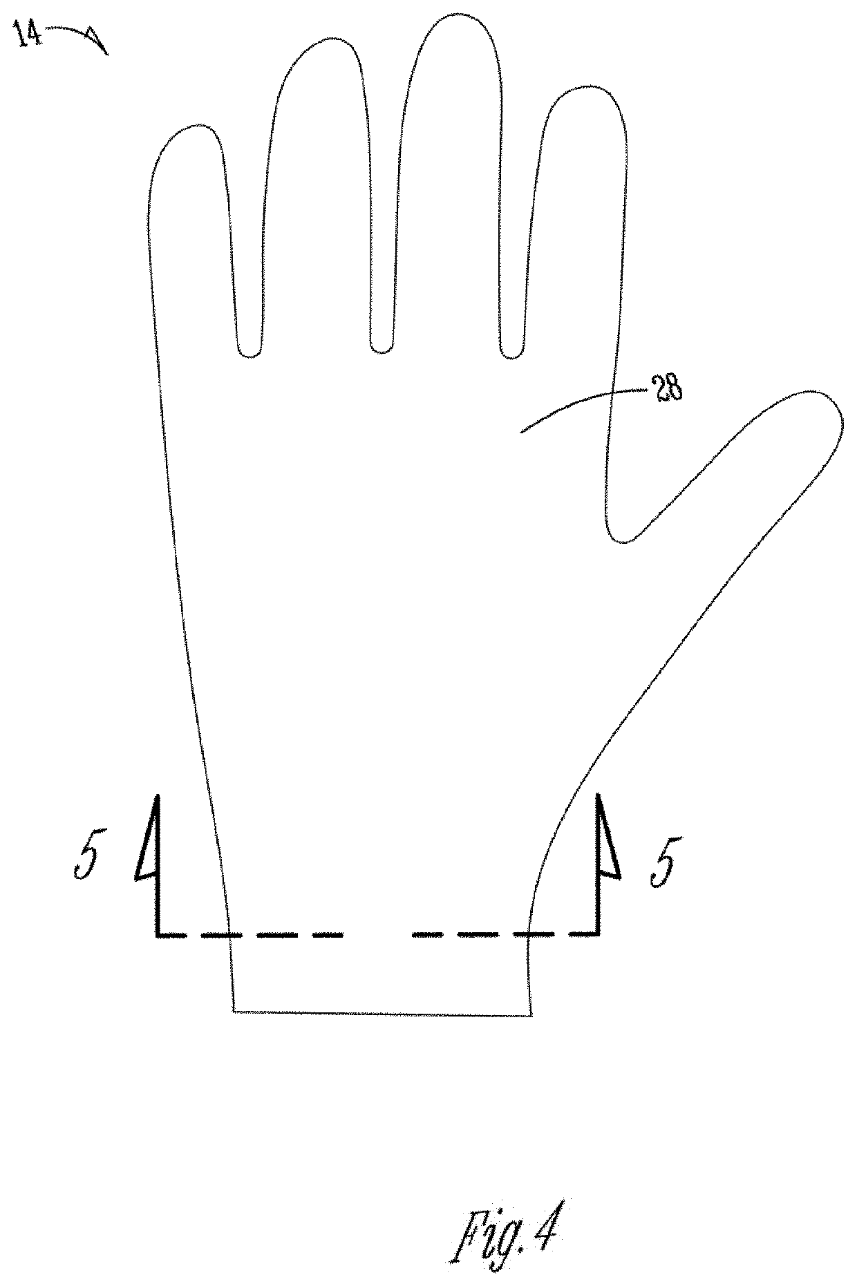 Ambidextrous hand compression therapeutic glove for remediating inflammation, swelling, and pain