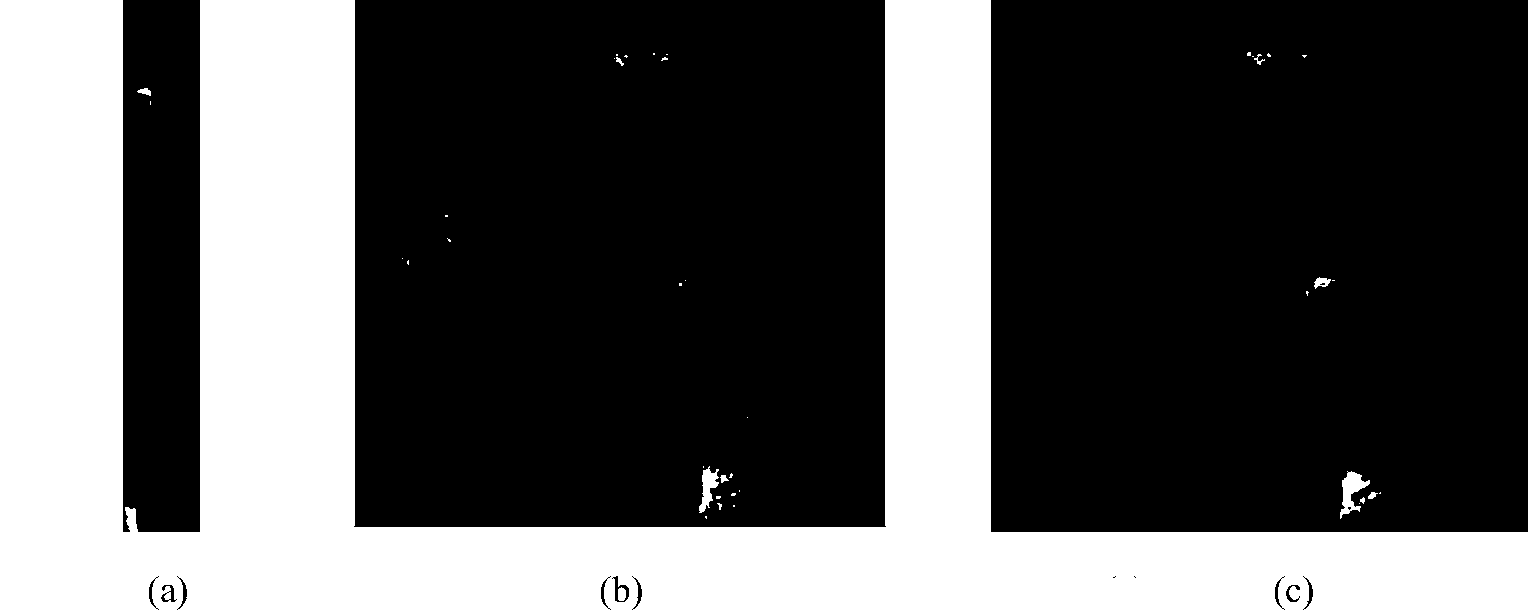 4D-MRI super-resolution reconstruction method based on double-dictionary learning