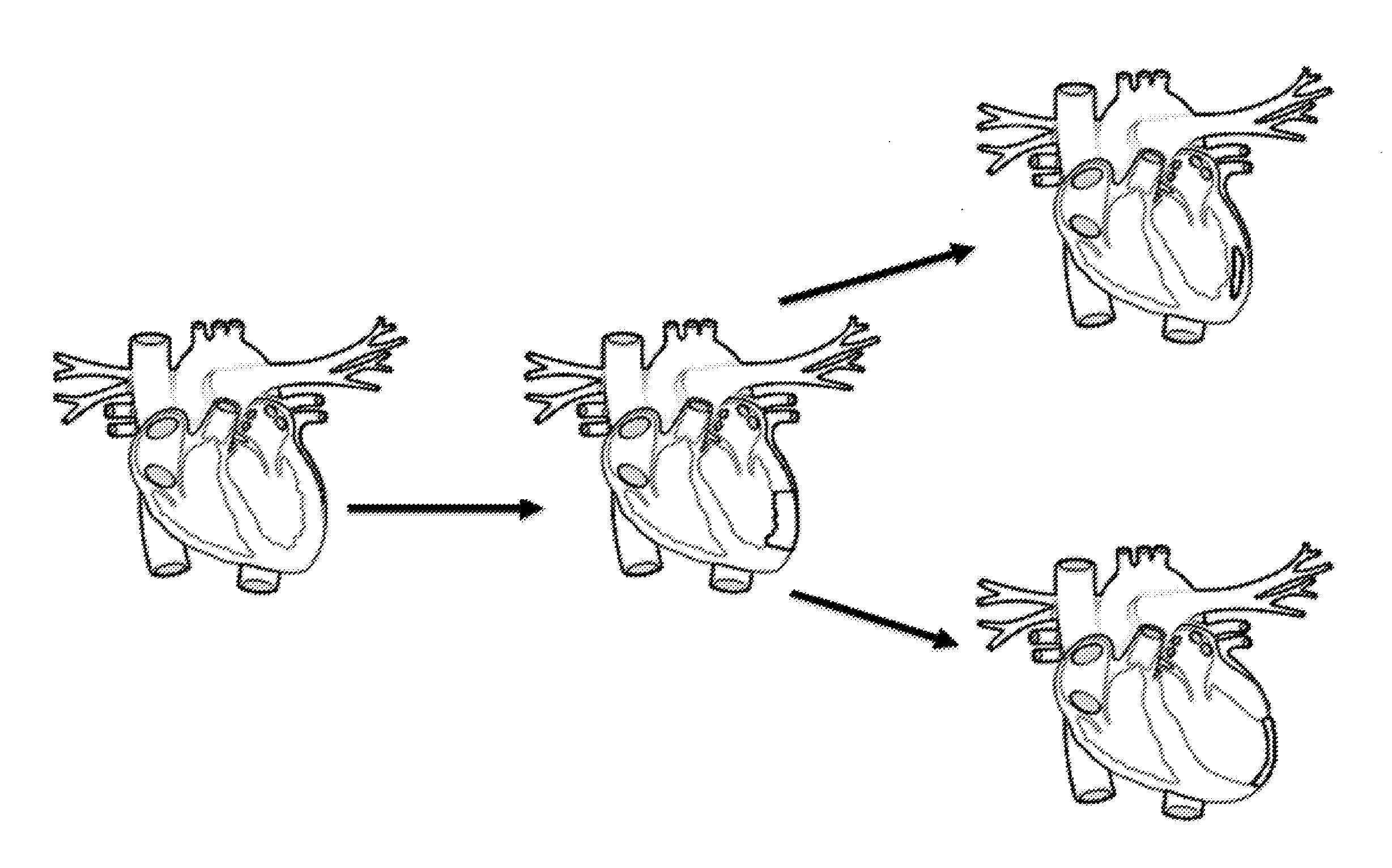 Compositions and Methods for Tissue Repair with Extracellular Matrices