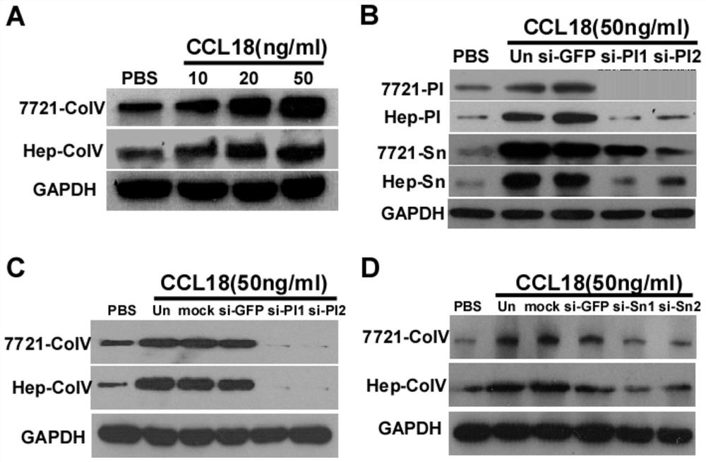 A kind of siRNA of silencing type IV collagen expression and its application