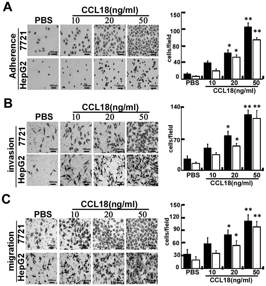 A kind of siRNA of silencing type IV collagen expression and its application