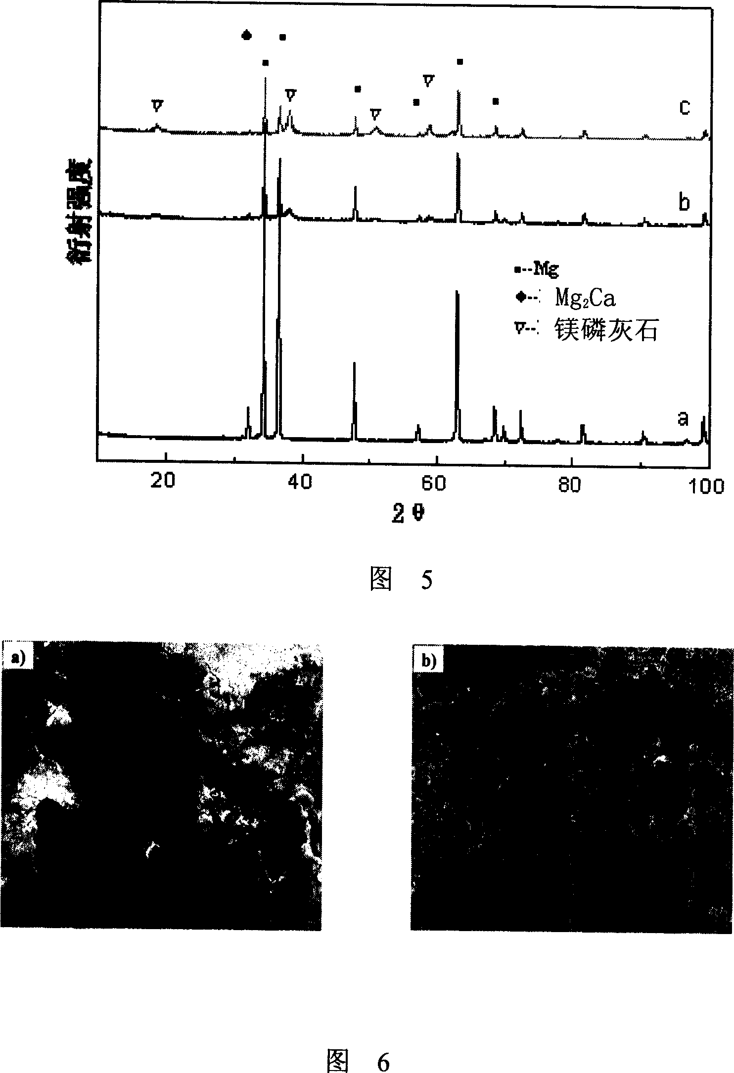 Medical implantation material capable of by degraded by body fluid and its preparing process