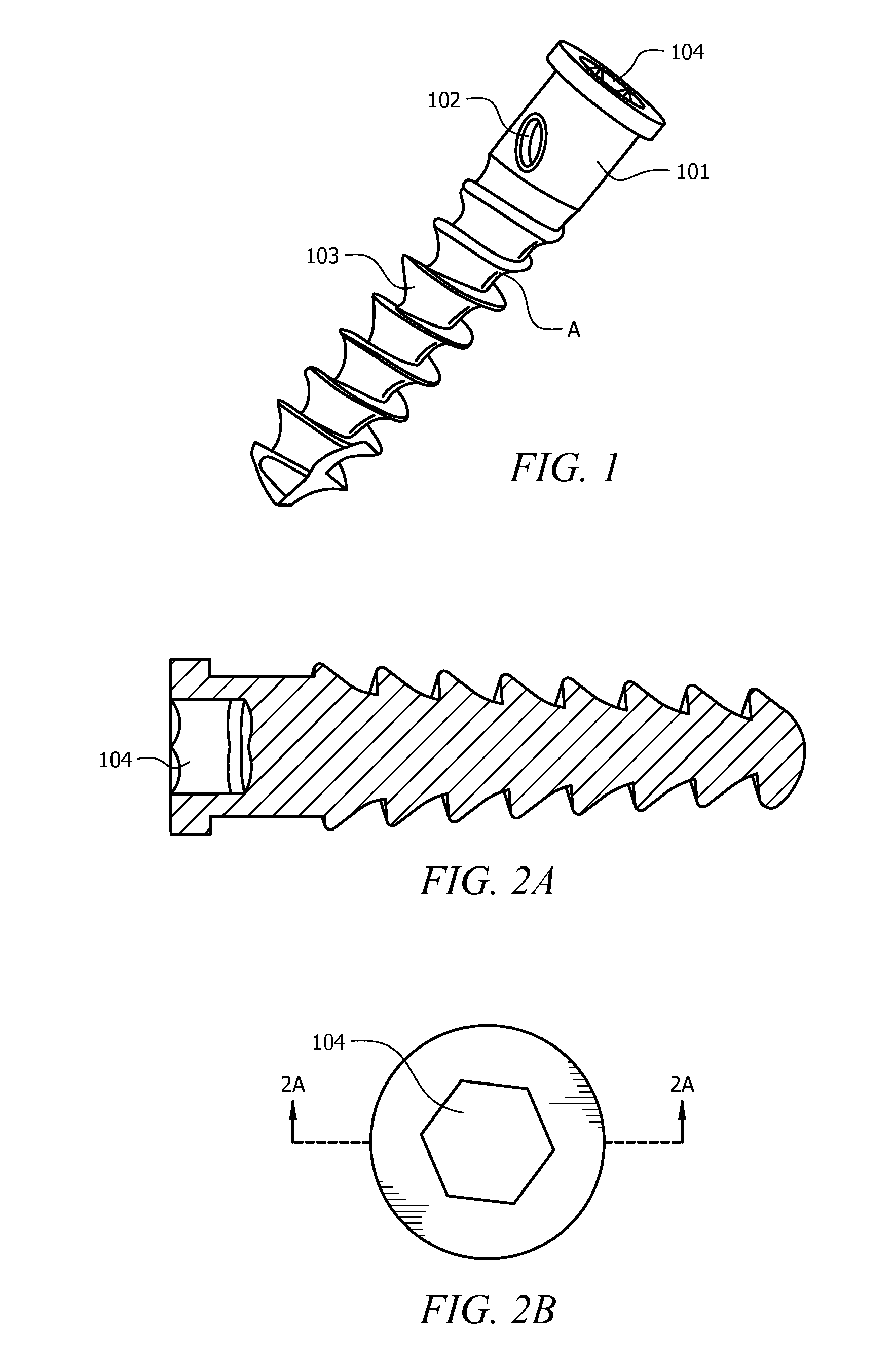 Universal anchor for attaching objects to bone tissue