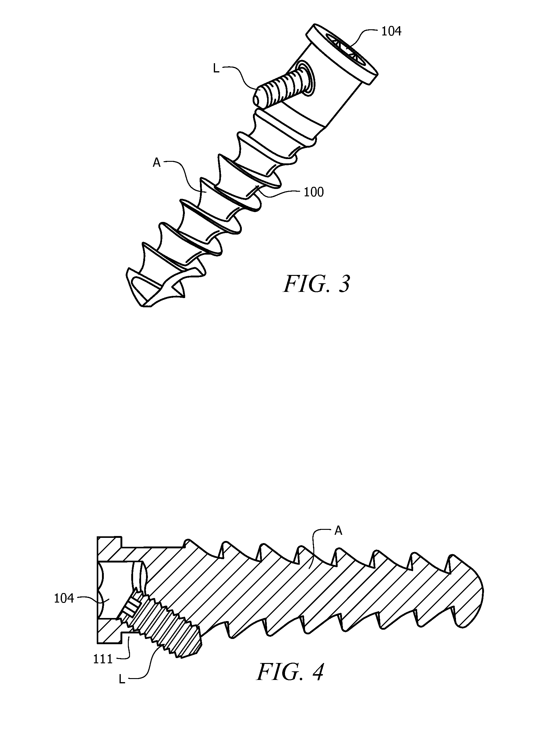 Universal anchor for attaching objects to bone tissue