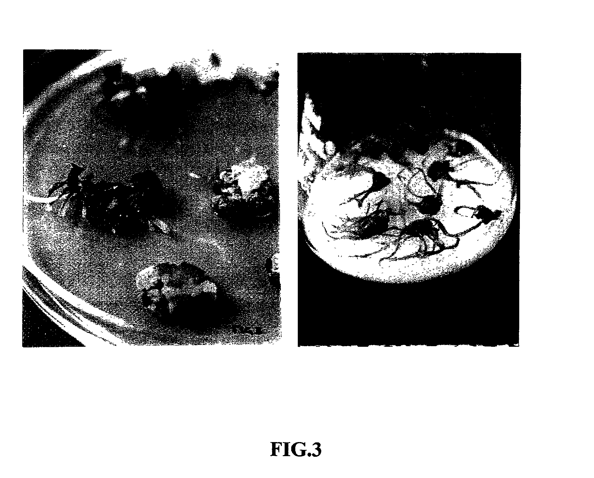 Method for microproduction of tea plants from leaf explants