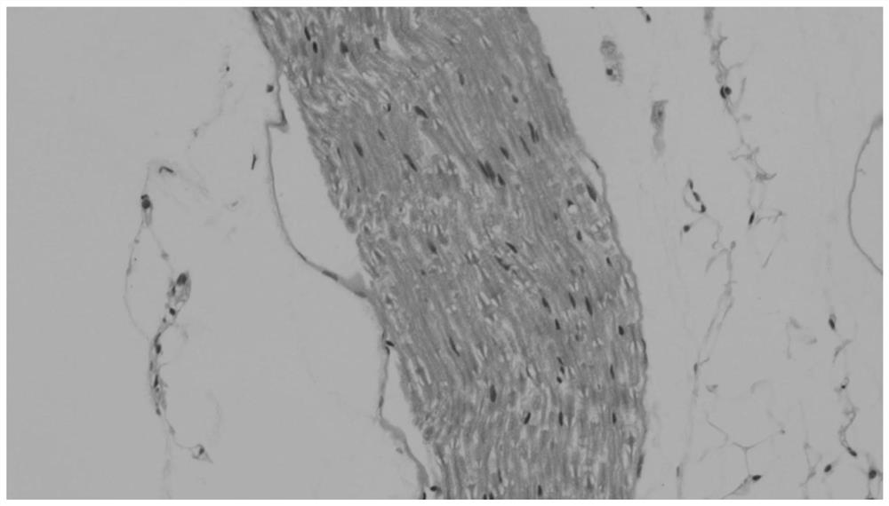 Establishment method of sciatic nerve injury model