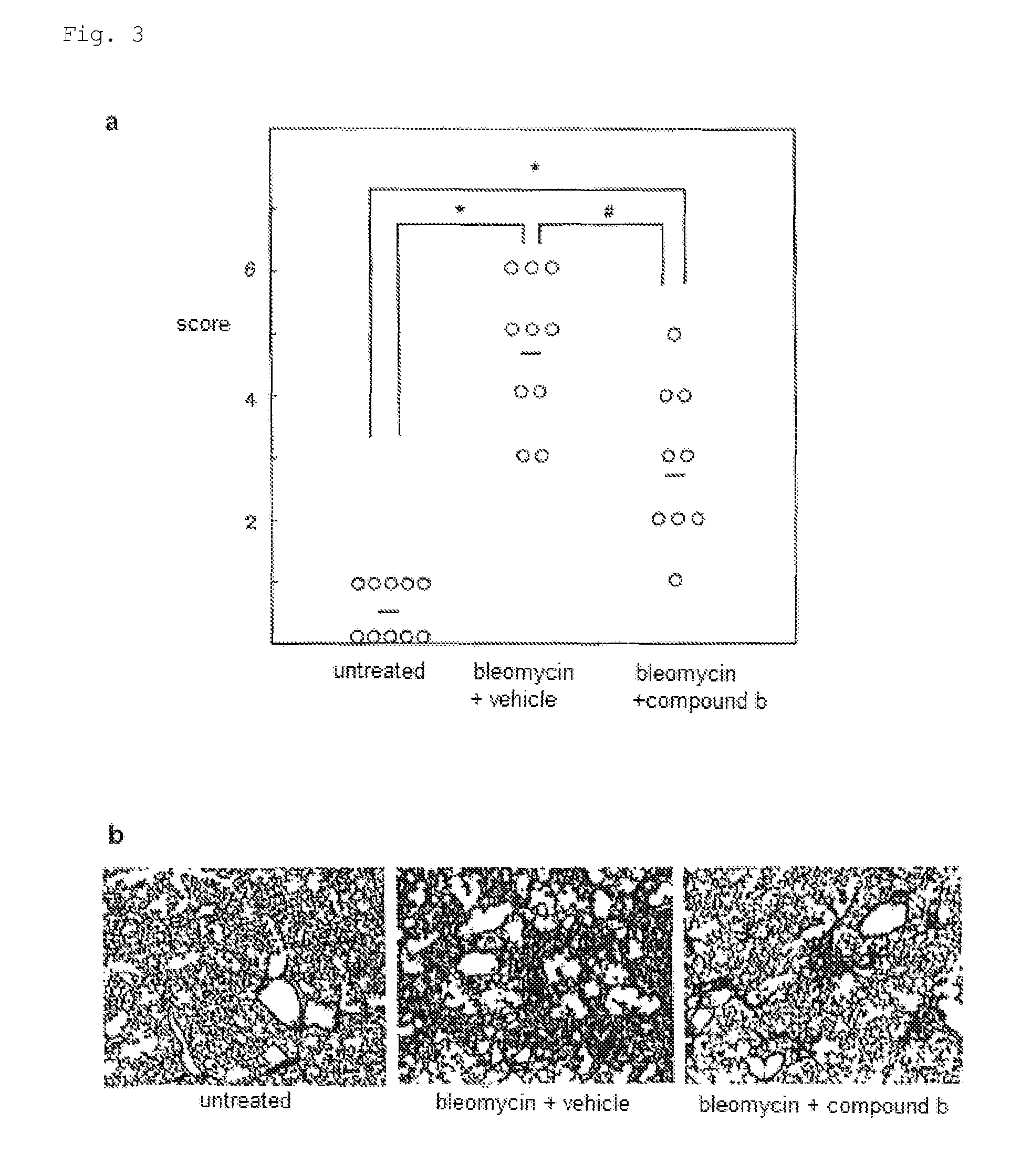 Plasminogen activator inhibitor-1 inhibitor