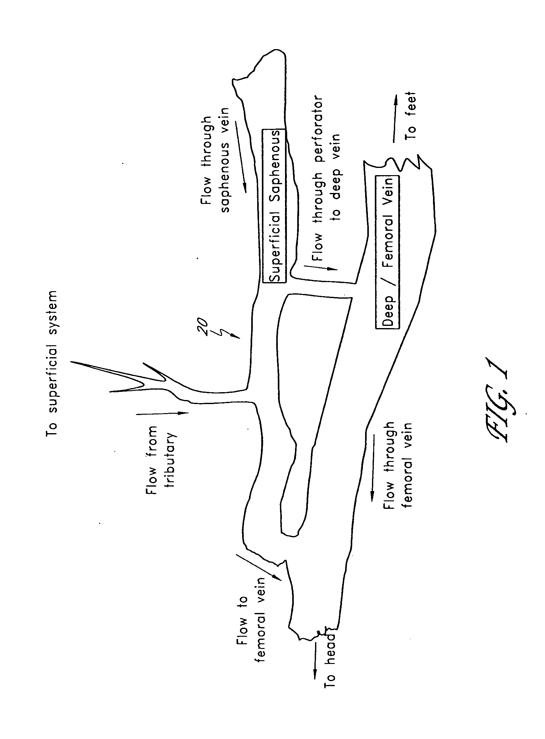 Occlusive implant and methods for hollow anatomical structure
