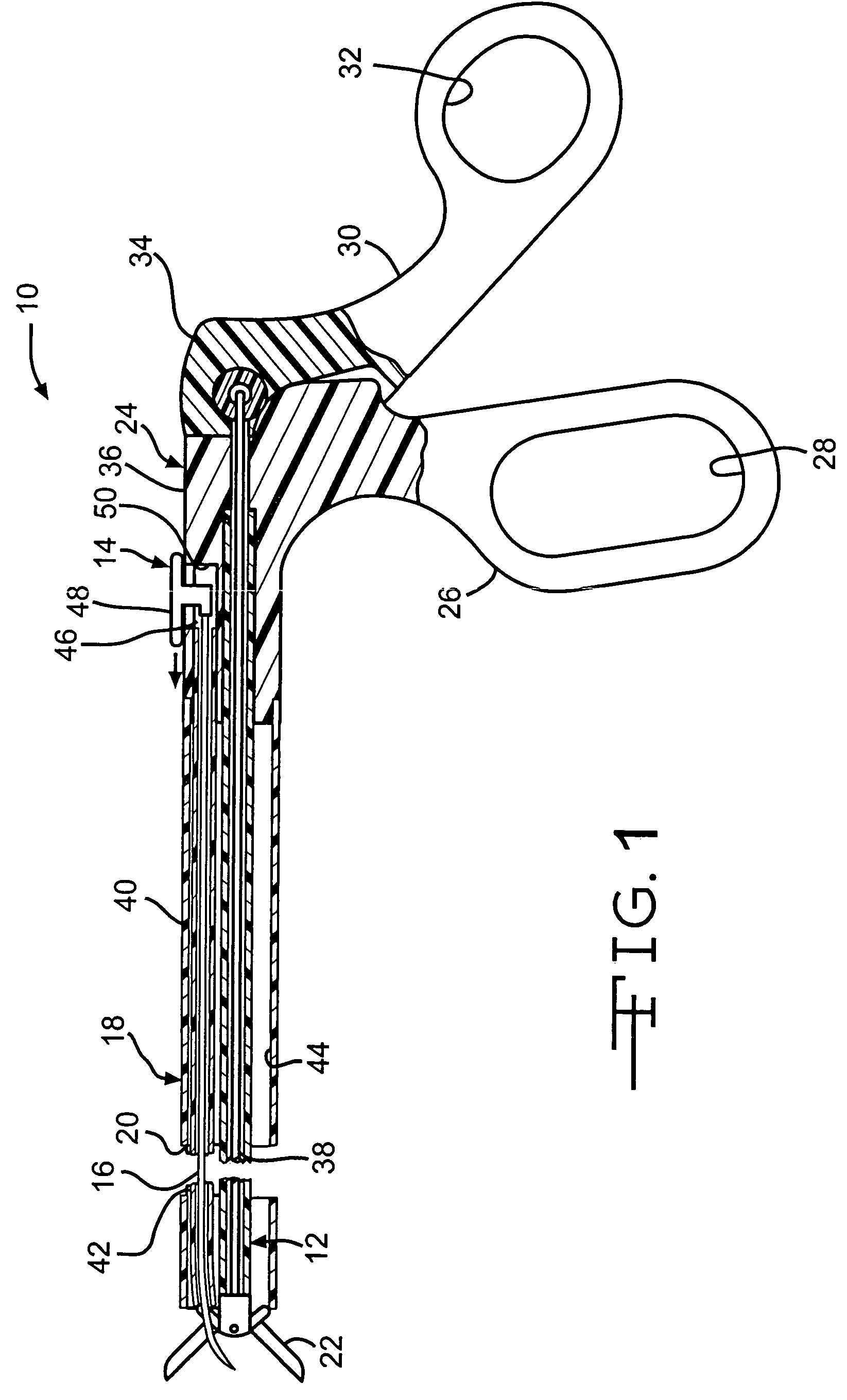 Device and method for intralumenal anastomosis