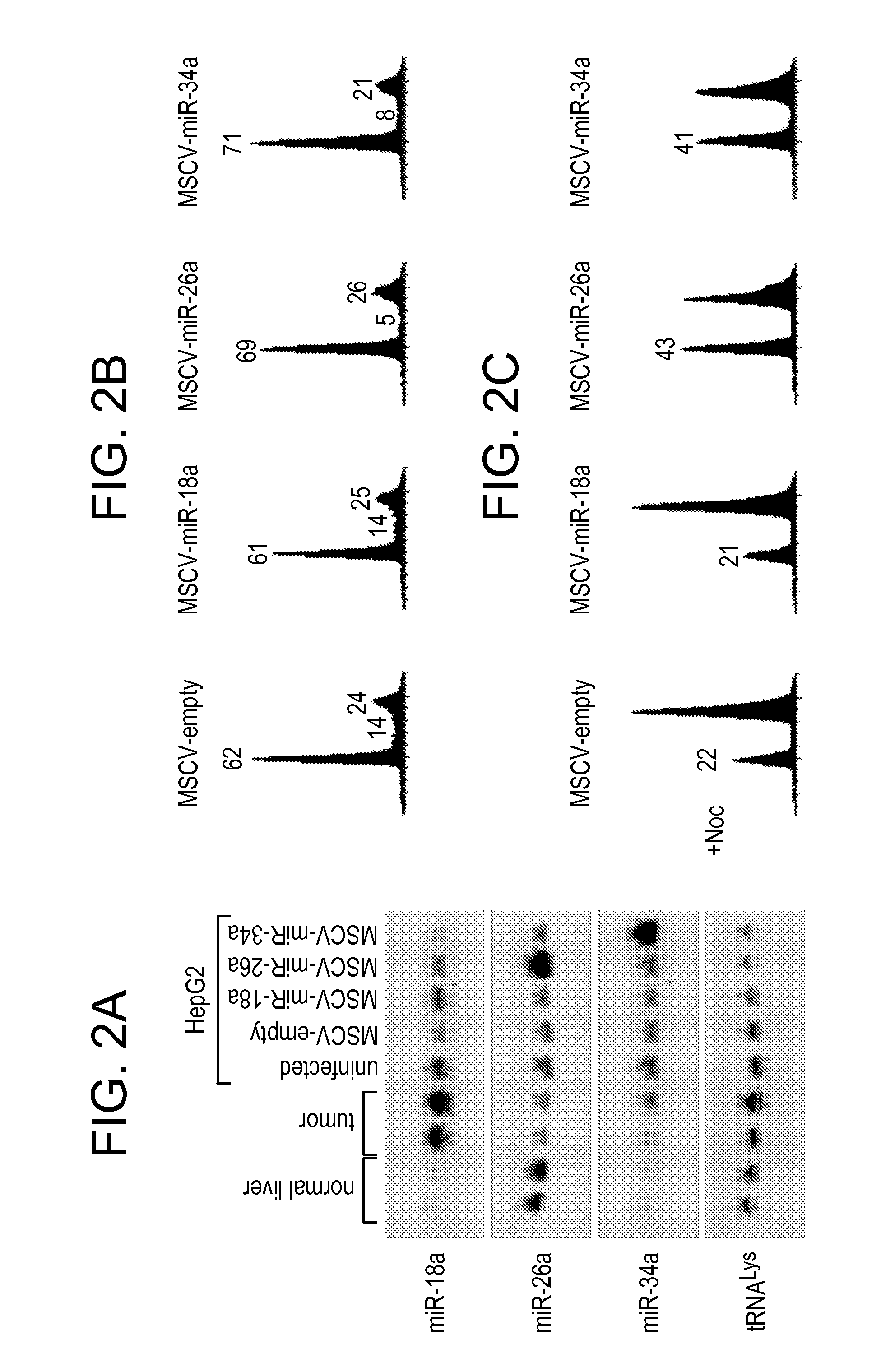 Compositions and methods for treating hepatic neoplasia