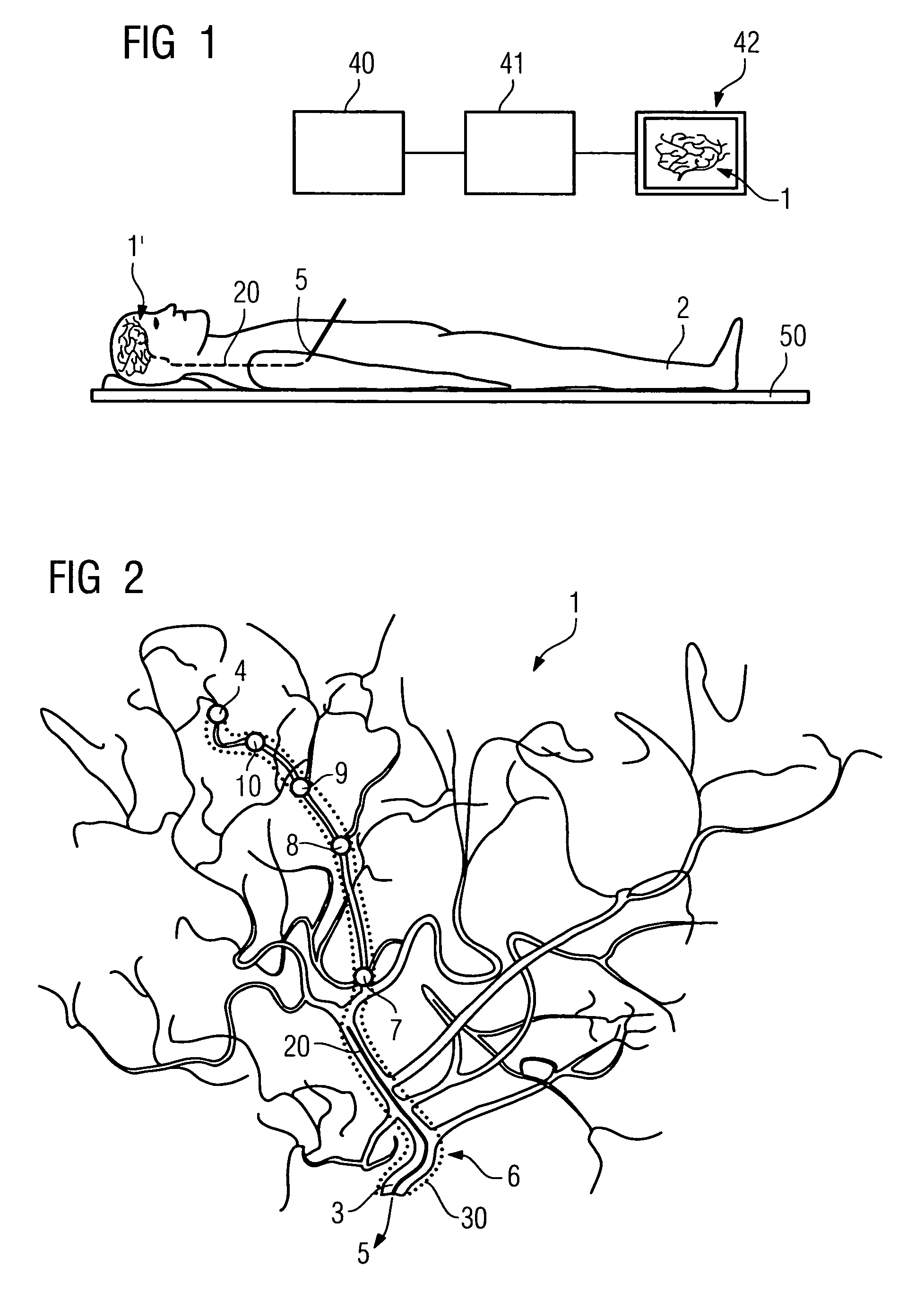Method for displaying a hollow space in an object under investigation