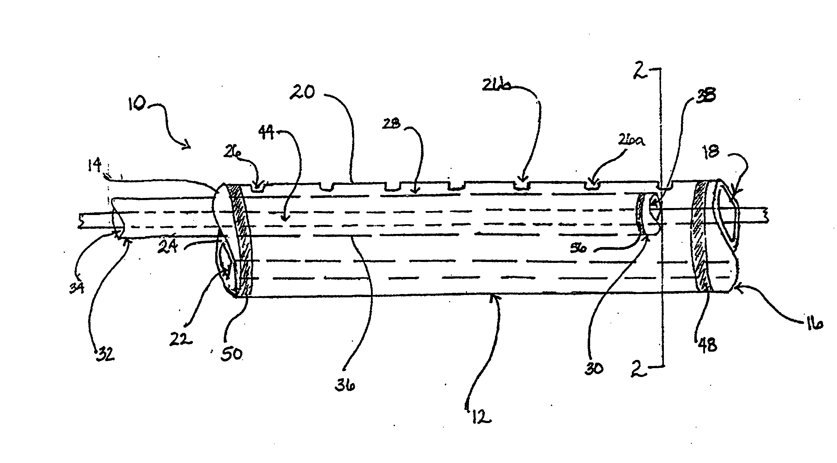 Infusion catheter system with telescoping cannula