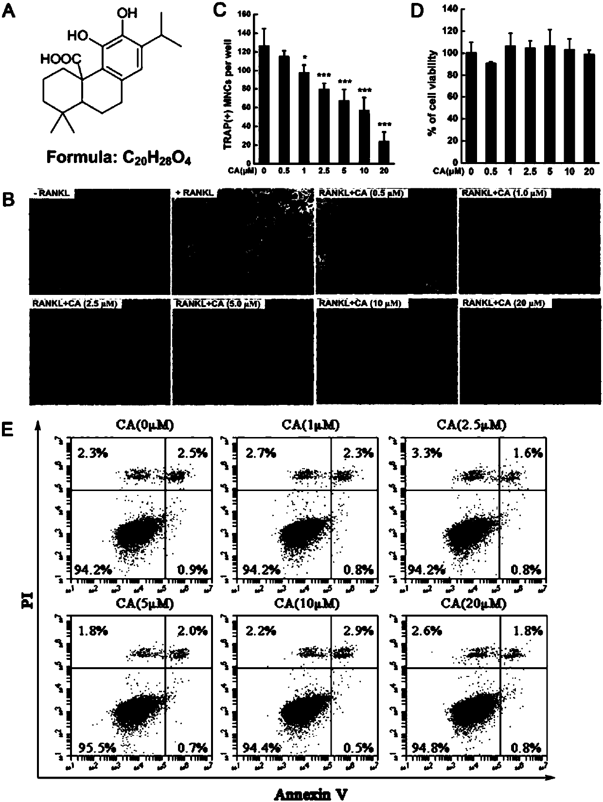 Application of carnosic acid in preparation of drugs for treating rheumatoid arthritis