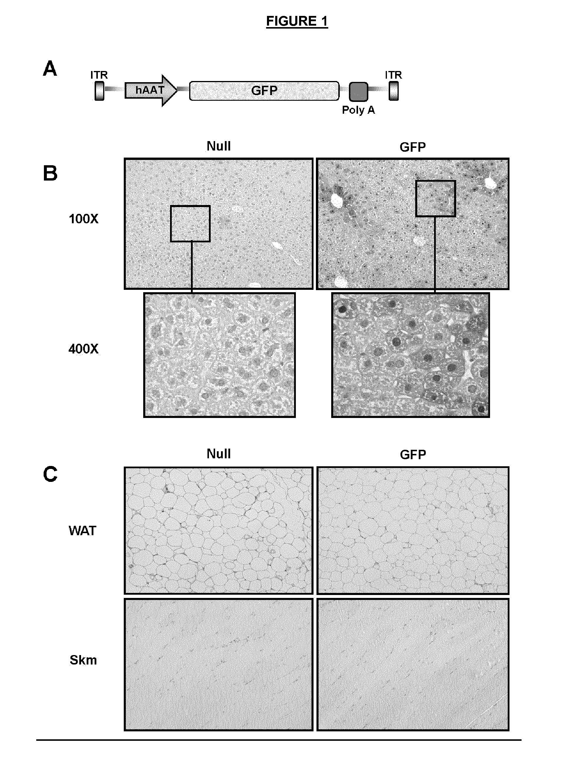 Gene therapy compositions for use in the prevention and/or treatment of non-alcoholic fatty liver disease