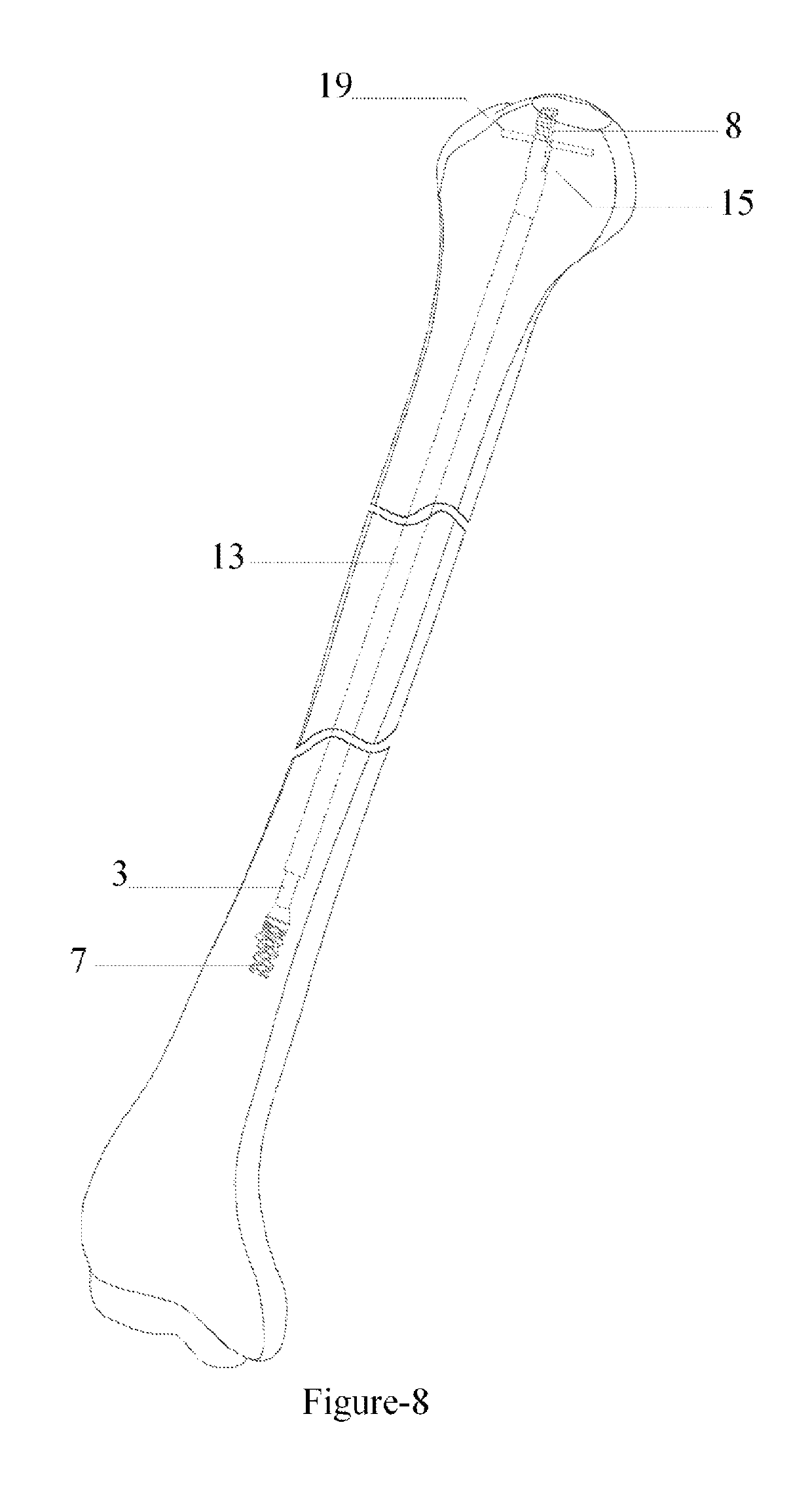 Telescopic nail