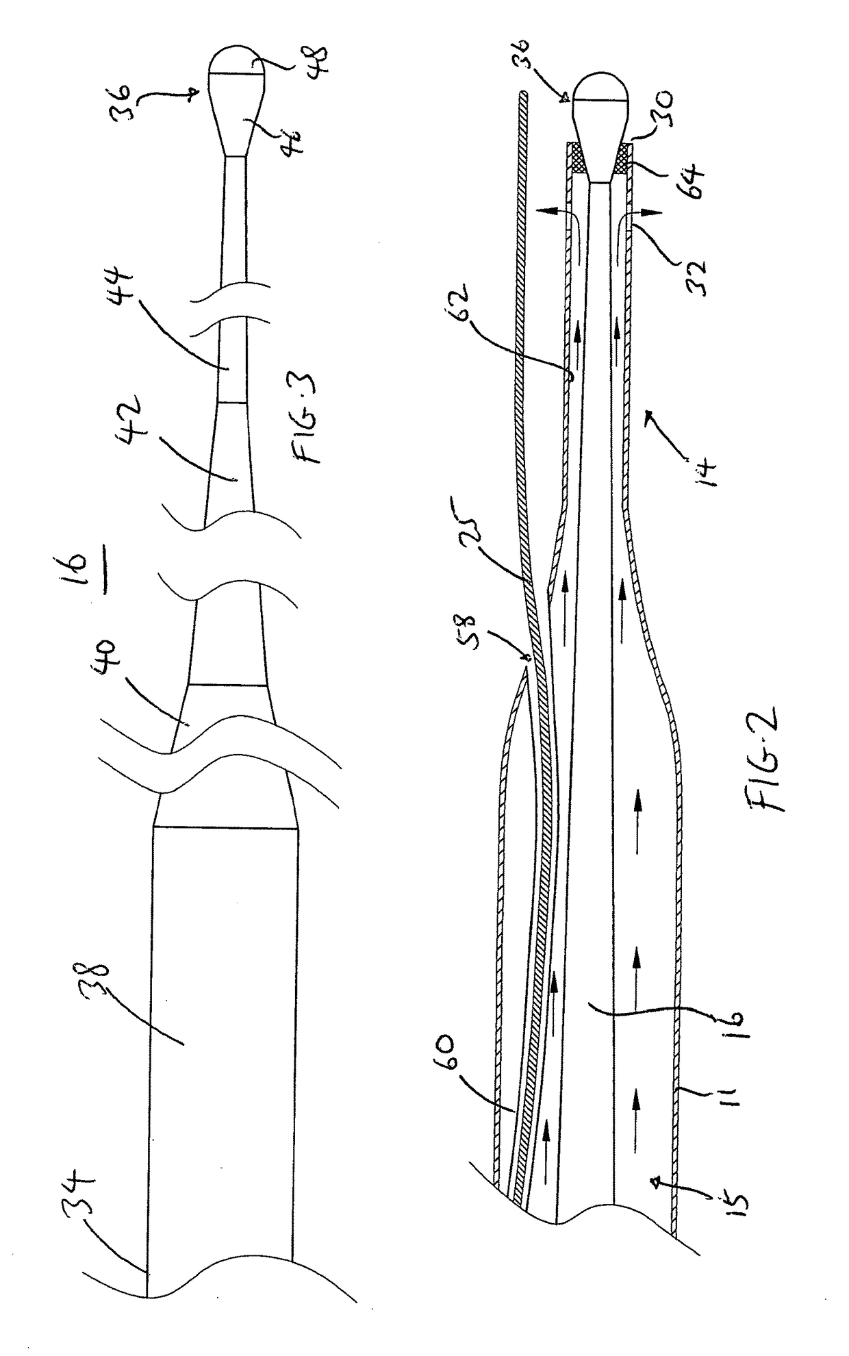 Ultrasound catheter having protective feature against breakage