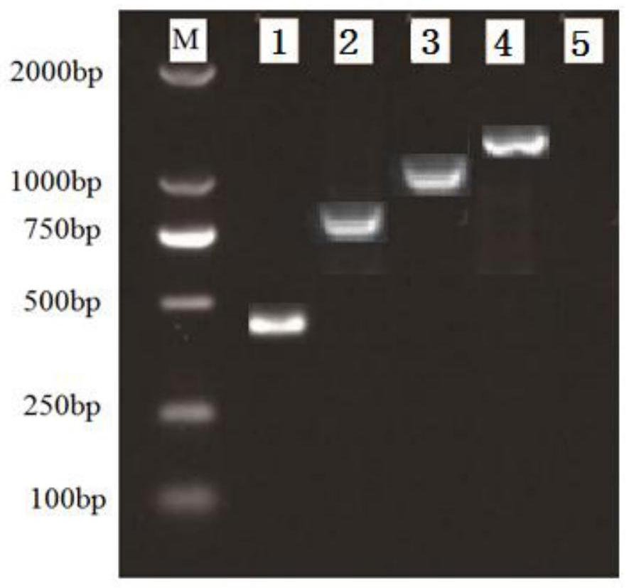 A kind of Streptomyces venezuela and its identification method and application