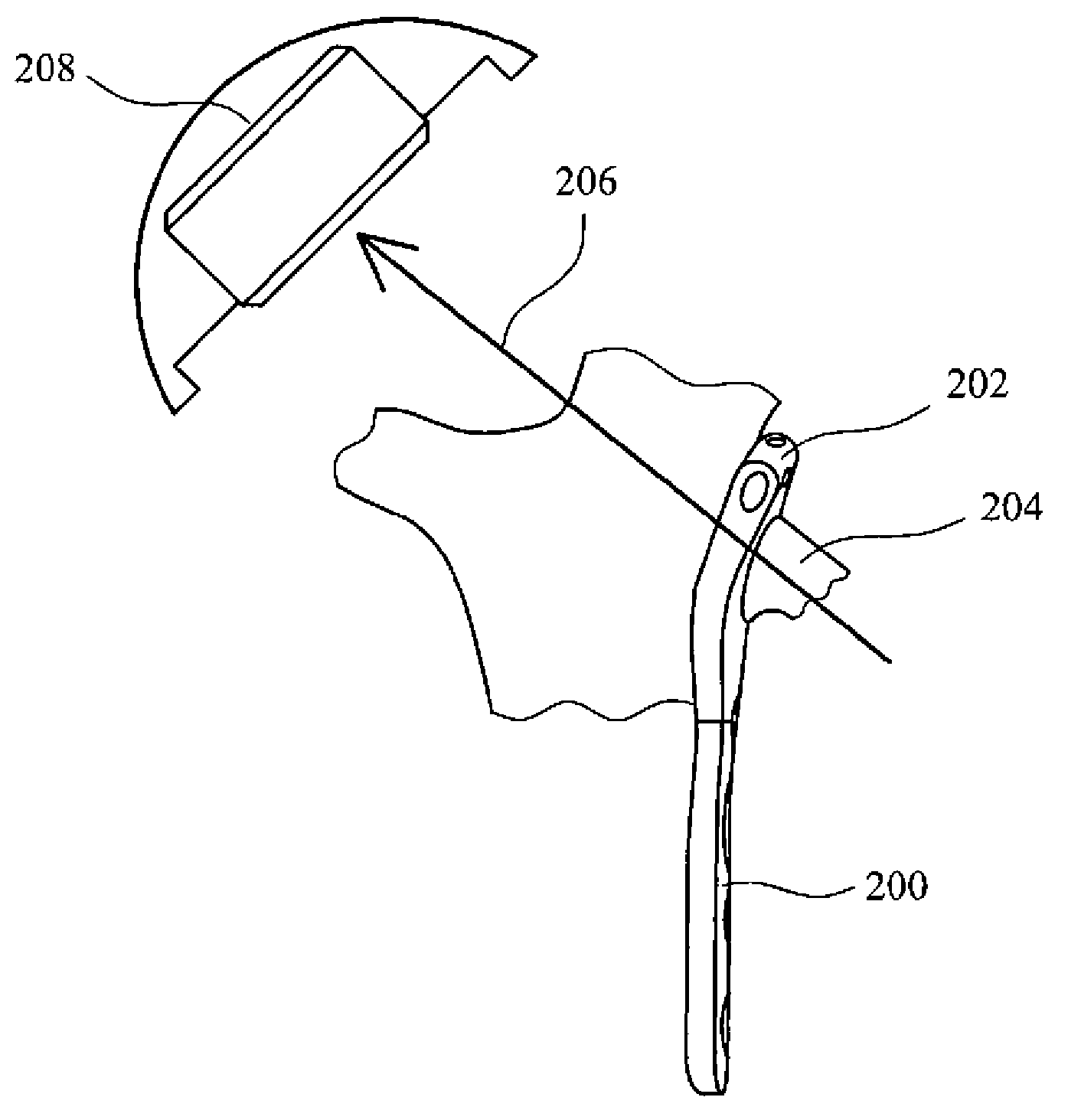 Arthroplasty plate