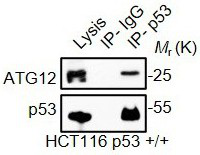 Application of promoting ATG5-ATG12 conjugation to enhance cell autophagy by removing wild type p53 protein