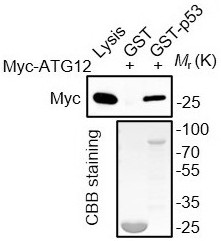 Application of promoting ATG5-ATG12 conjugation to enhance cell autophagy by removing wild type p53 protein