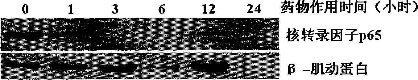 Berbamine derivative and application of salt thereof