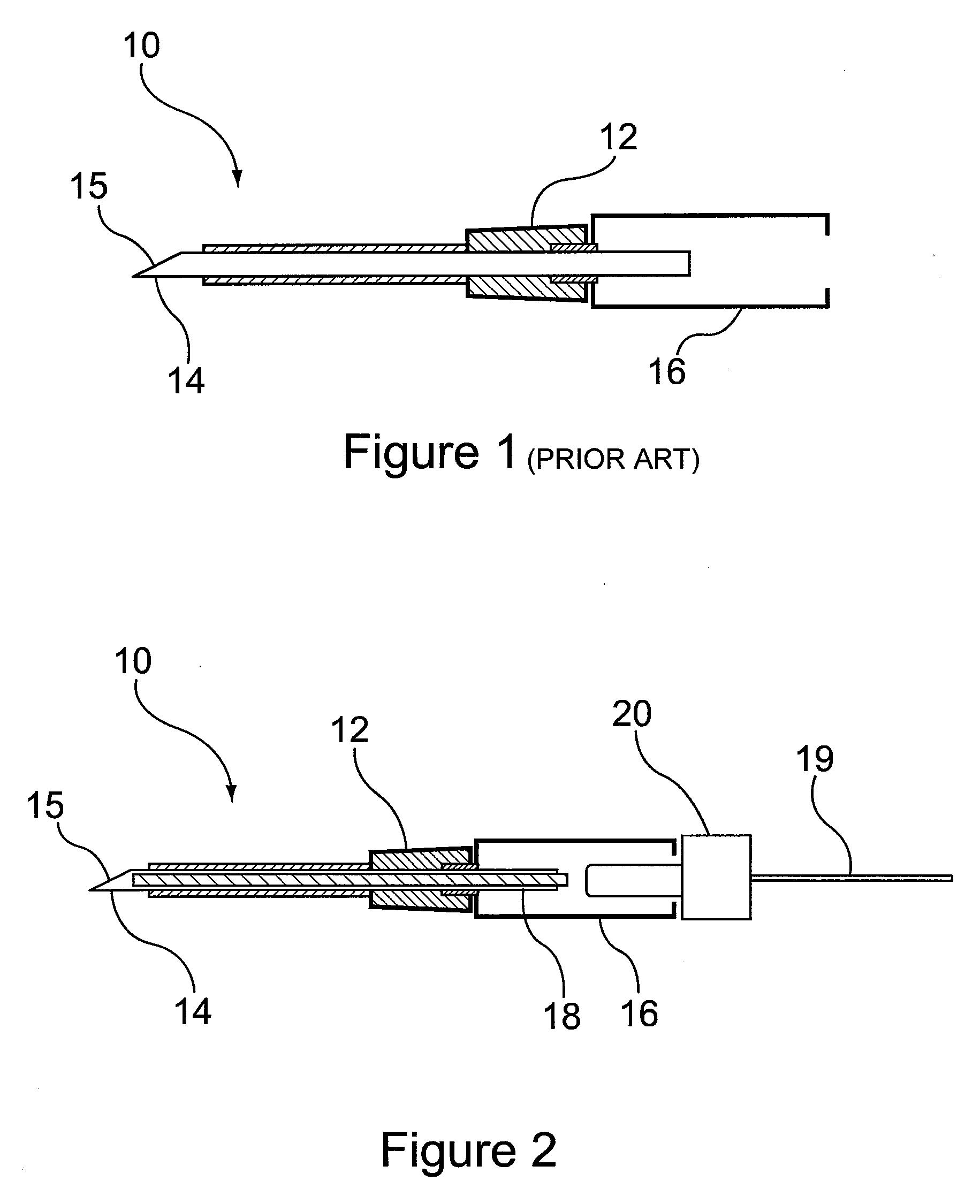 Method and apparatus for detection of catheter location for intravenous access