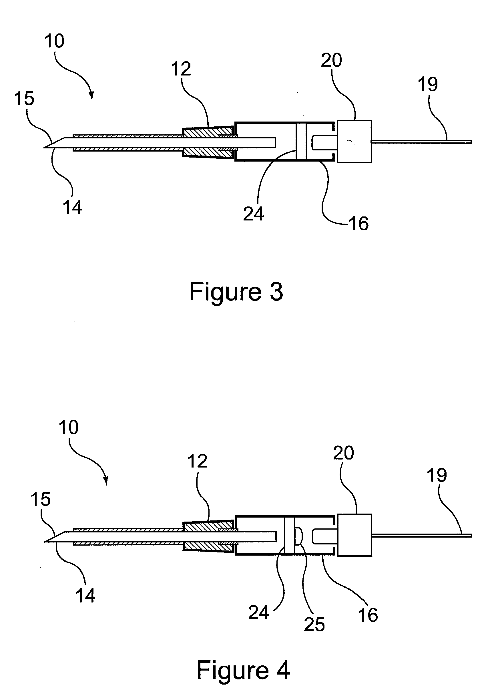 Method and apparatus for detection of catheter location for intravenous access