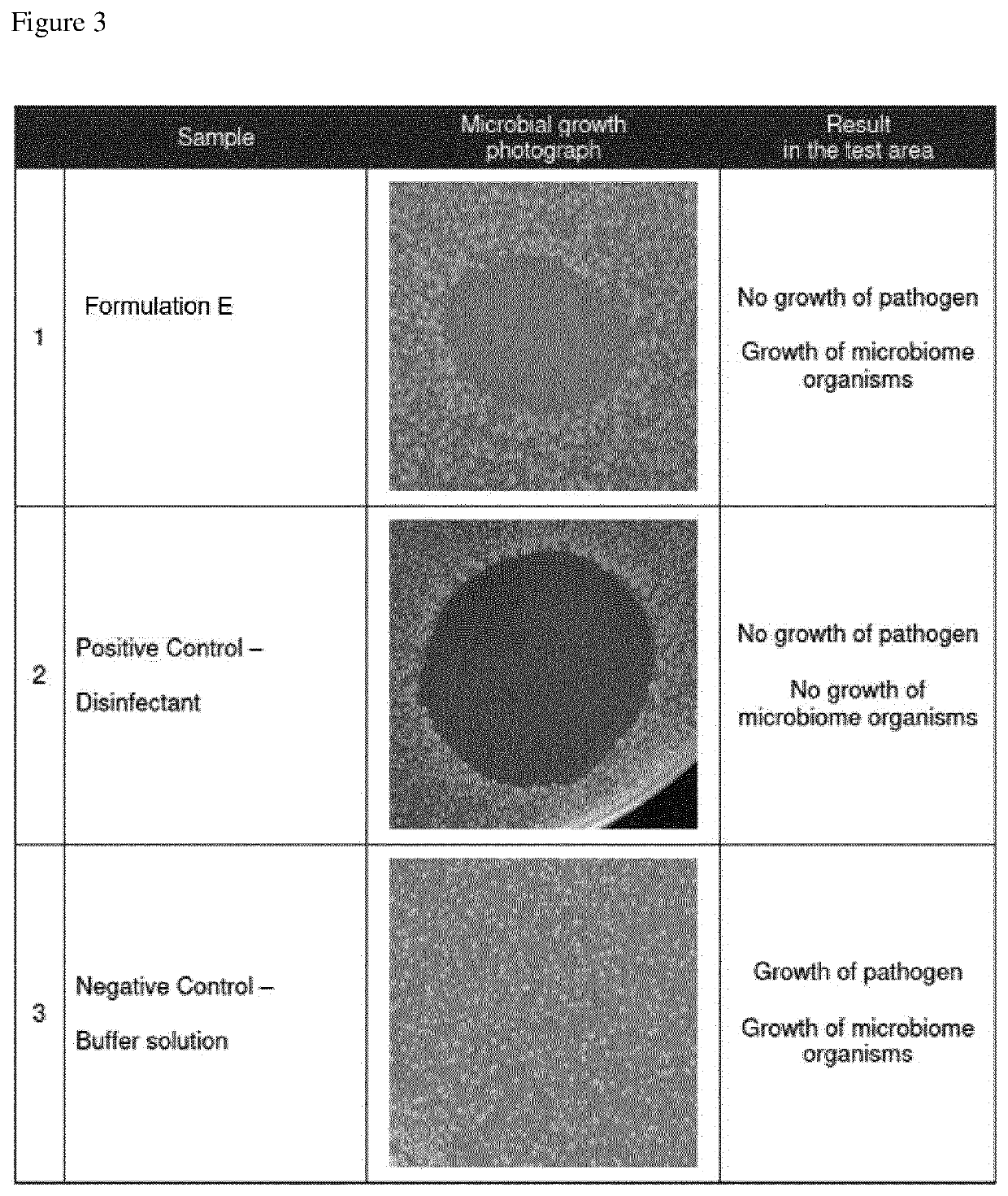 Liquid composition for influencing the microbiota on a subject's skin comprising chitosan