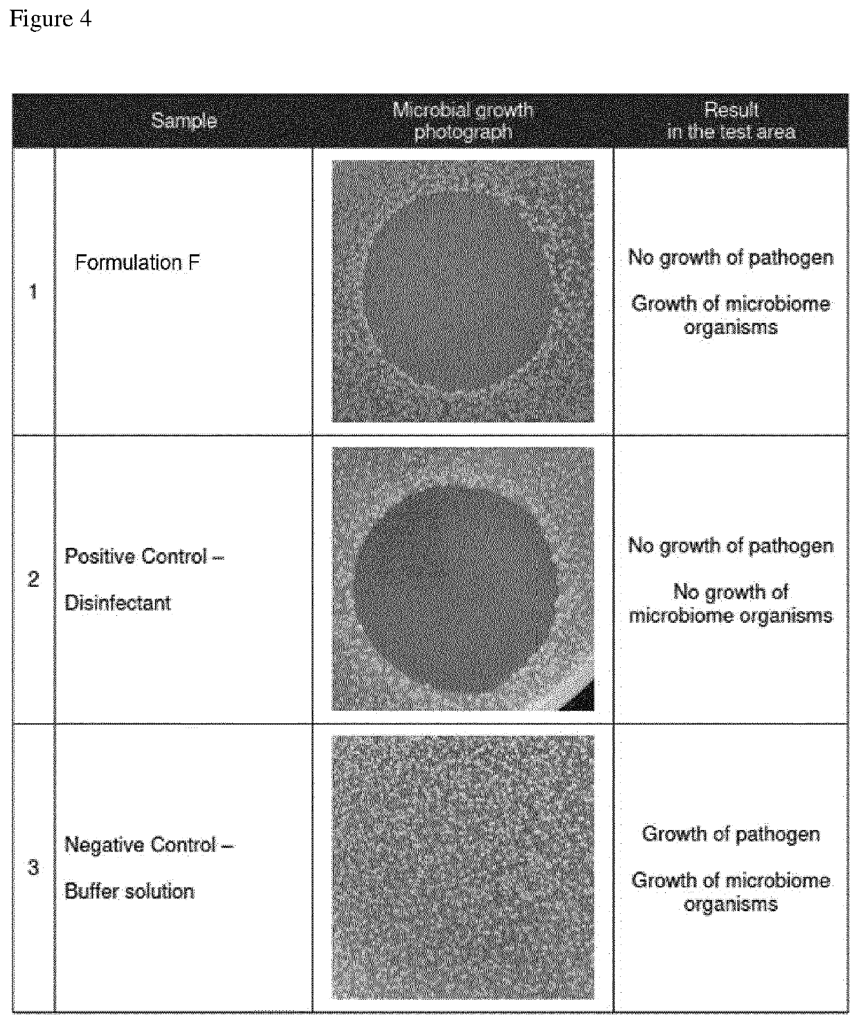 Liquid composition for influencing the microbiota on a subject's skin comprising chitosan