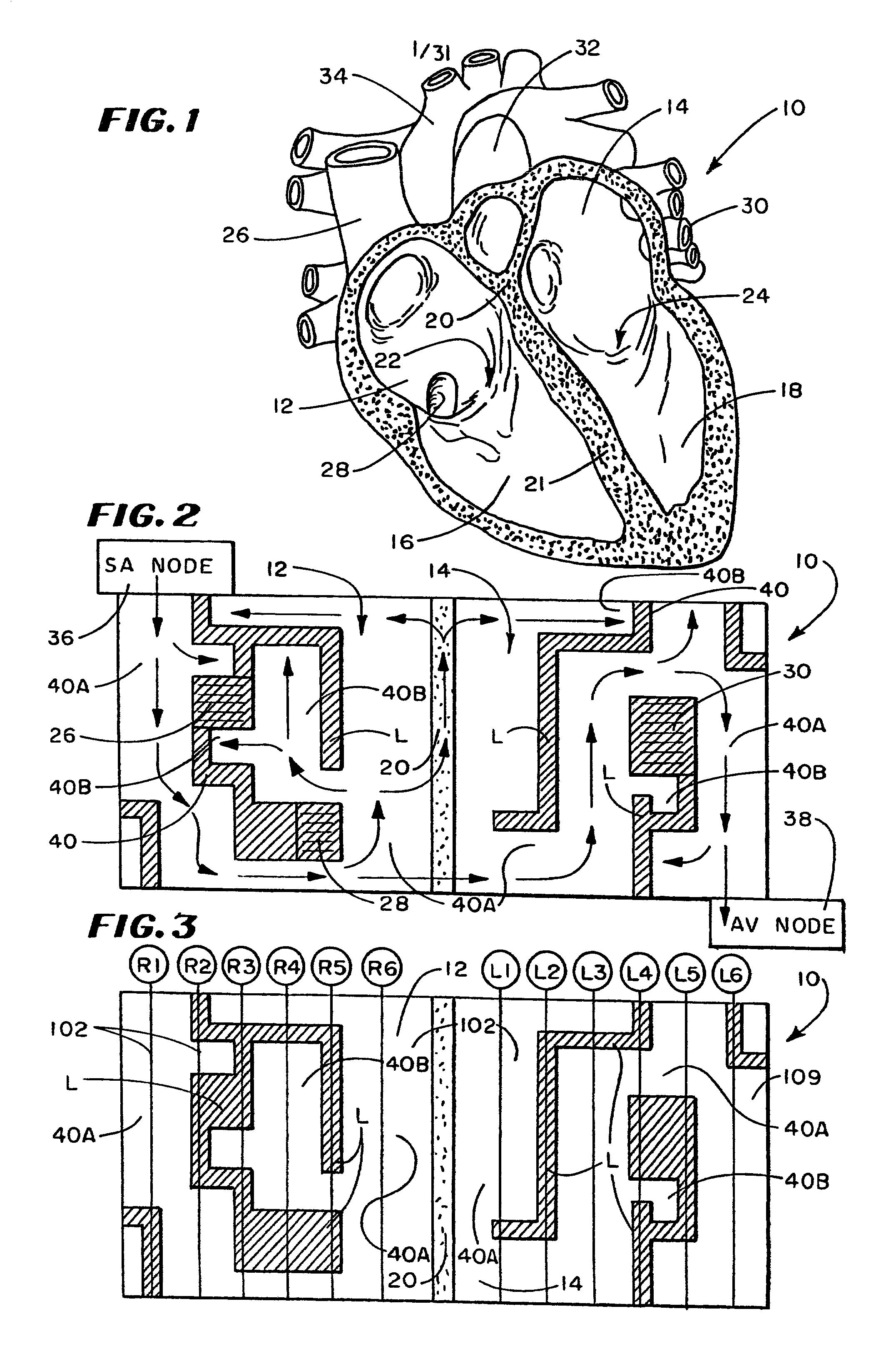 Composite structures and methods for ablating tissue to form complex lesion patterns in the treatment of cardiac conditions and the like