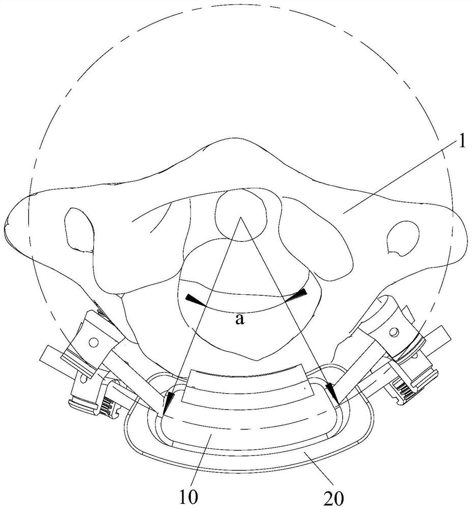 Atlantoaxial joint prosthesis