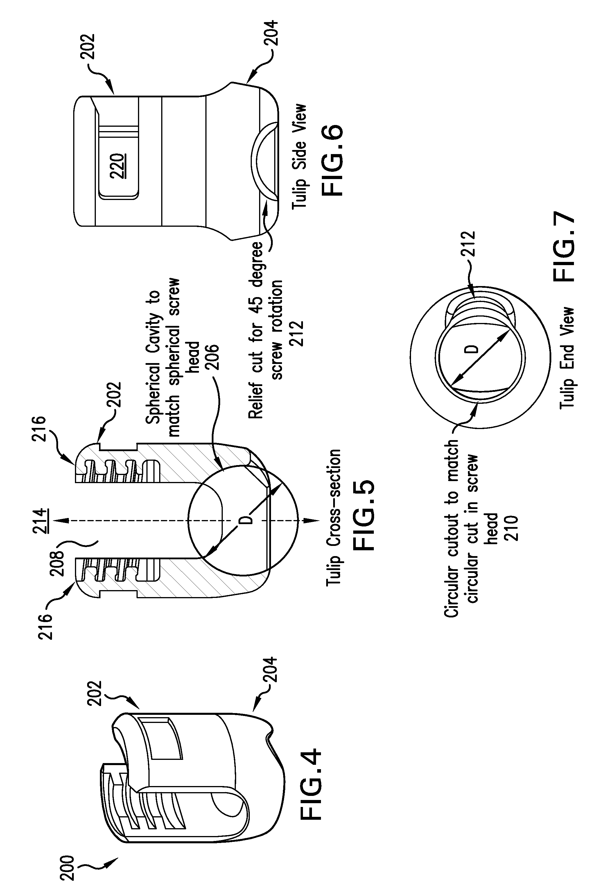 Spinal stabilization systems and methods