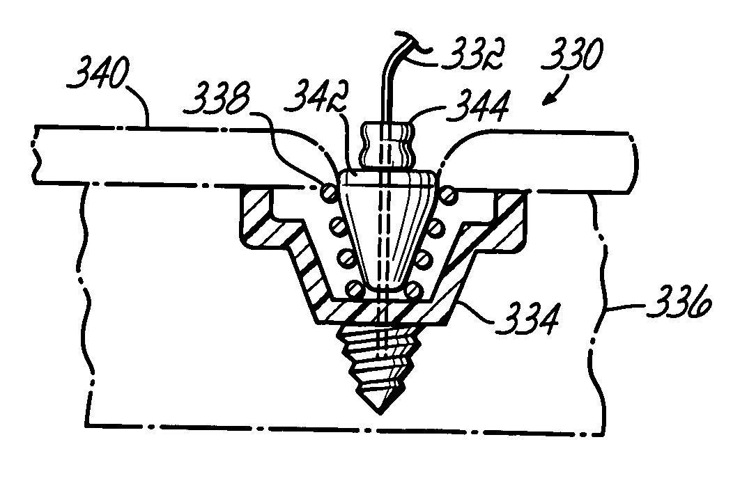 Apparatus and methods for securing tendons or ligaments to bone