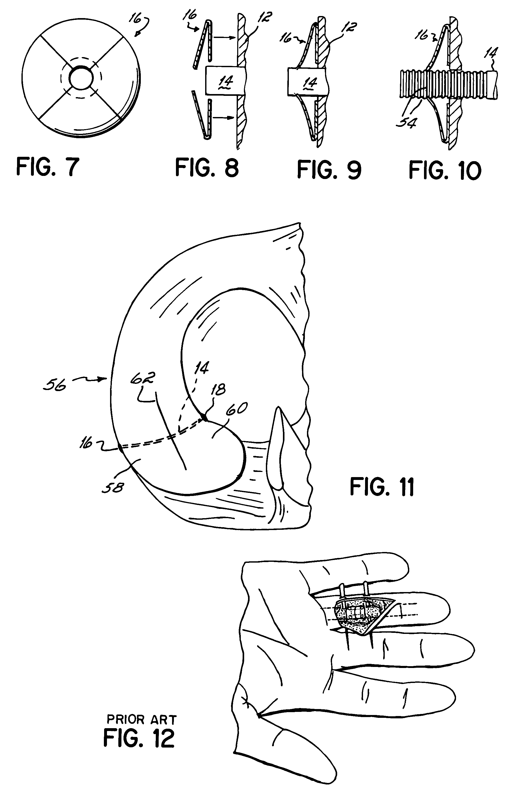 Apparatus and methods for securing tendons or ligaments to bone