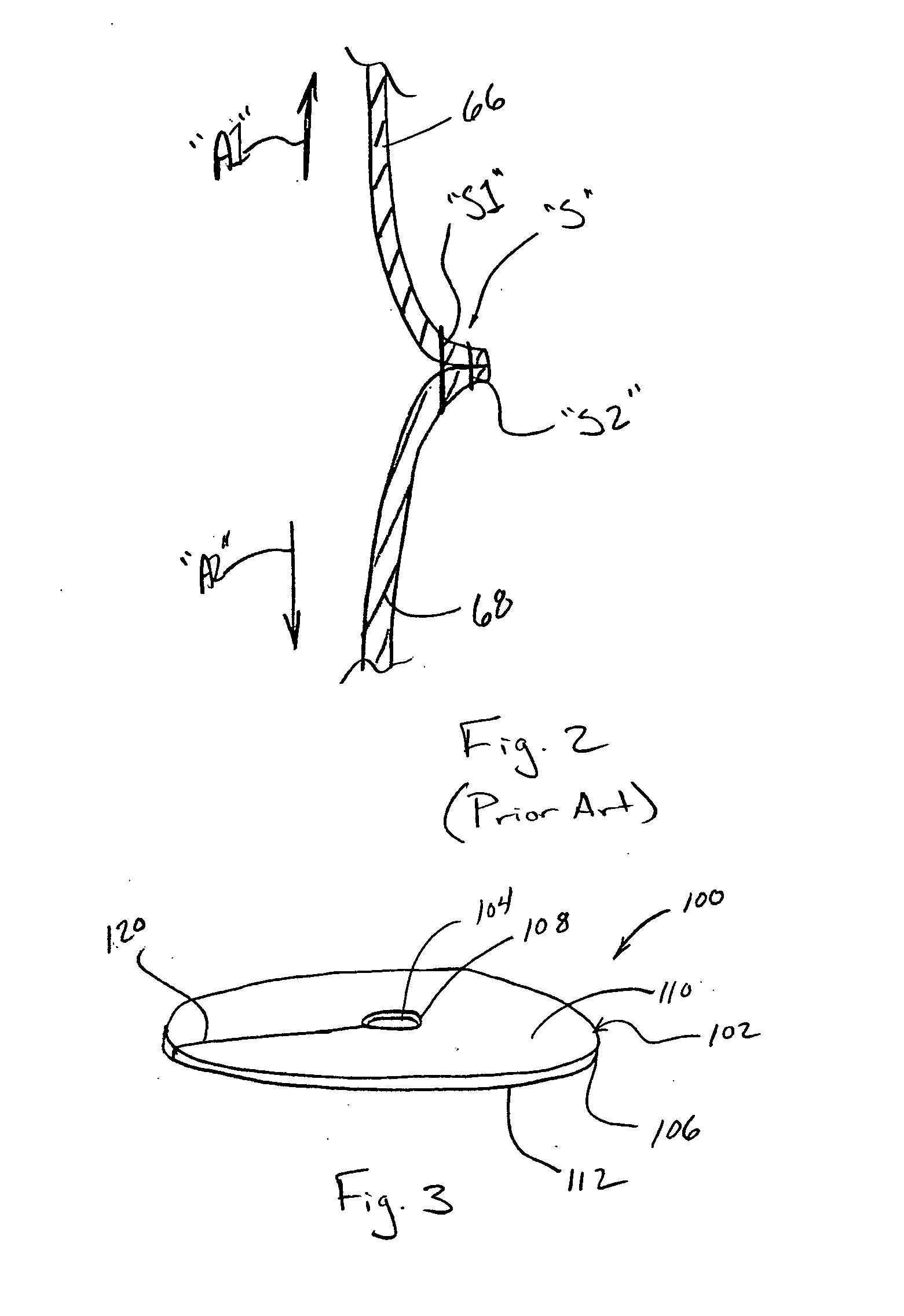 Annular disk for reduction of anastomotic tension and methods of using the same