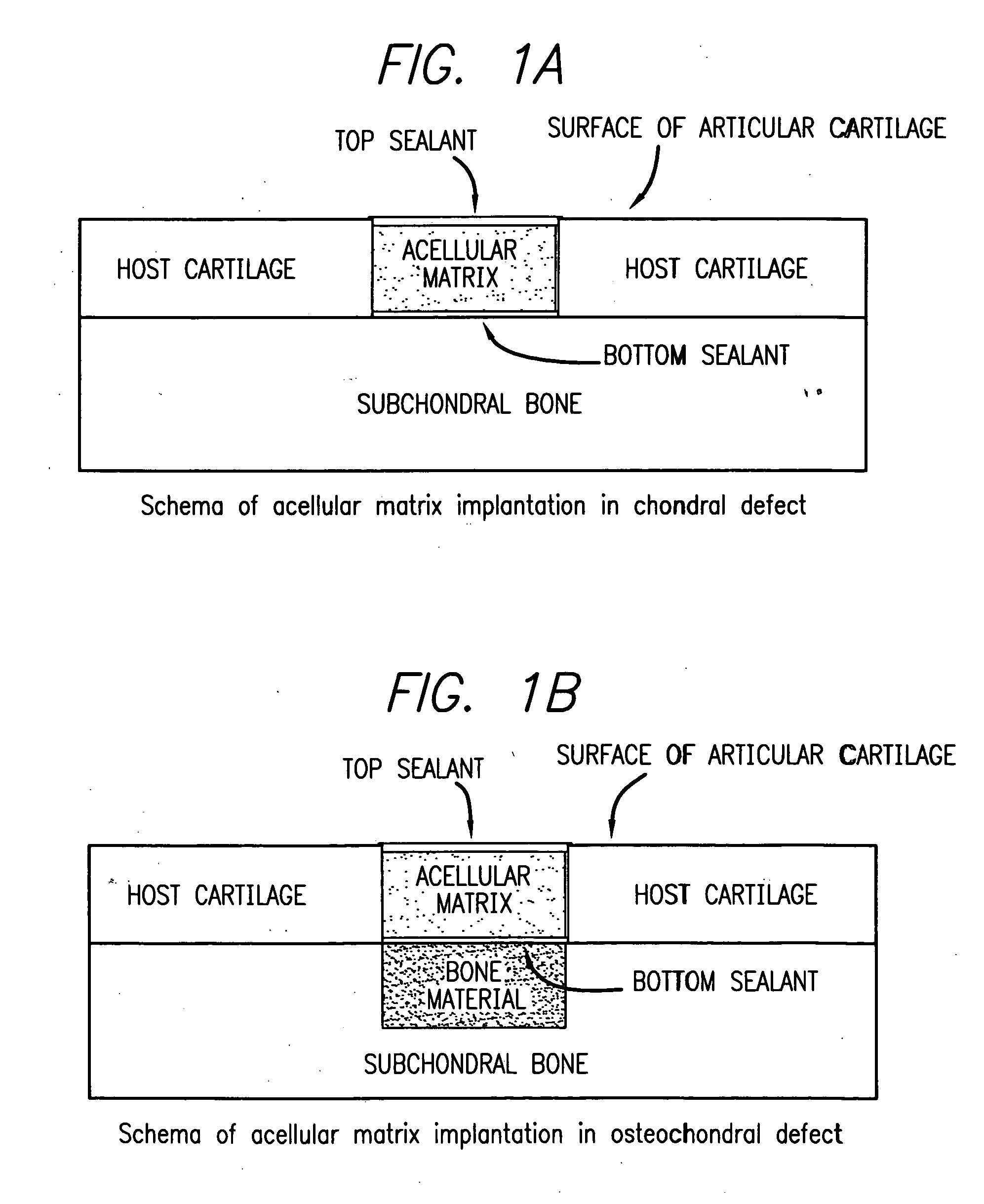 Acellular matrix implants for treatment of articular cartilage, bone or osteochondral defects and injuries and method for use thereof