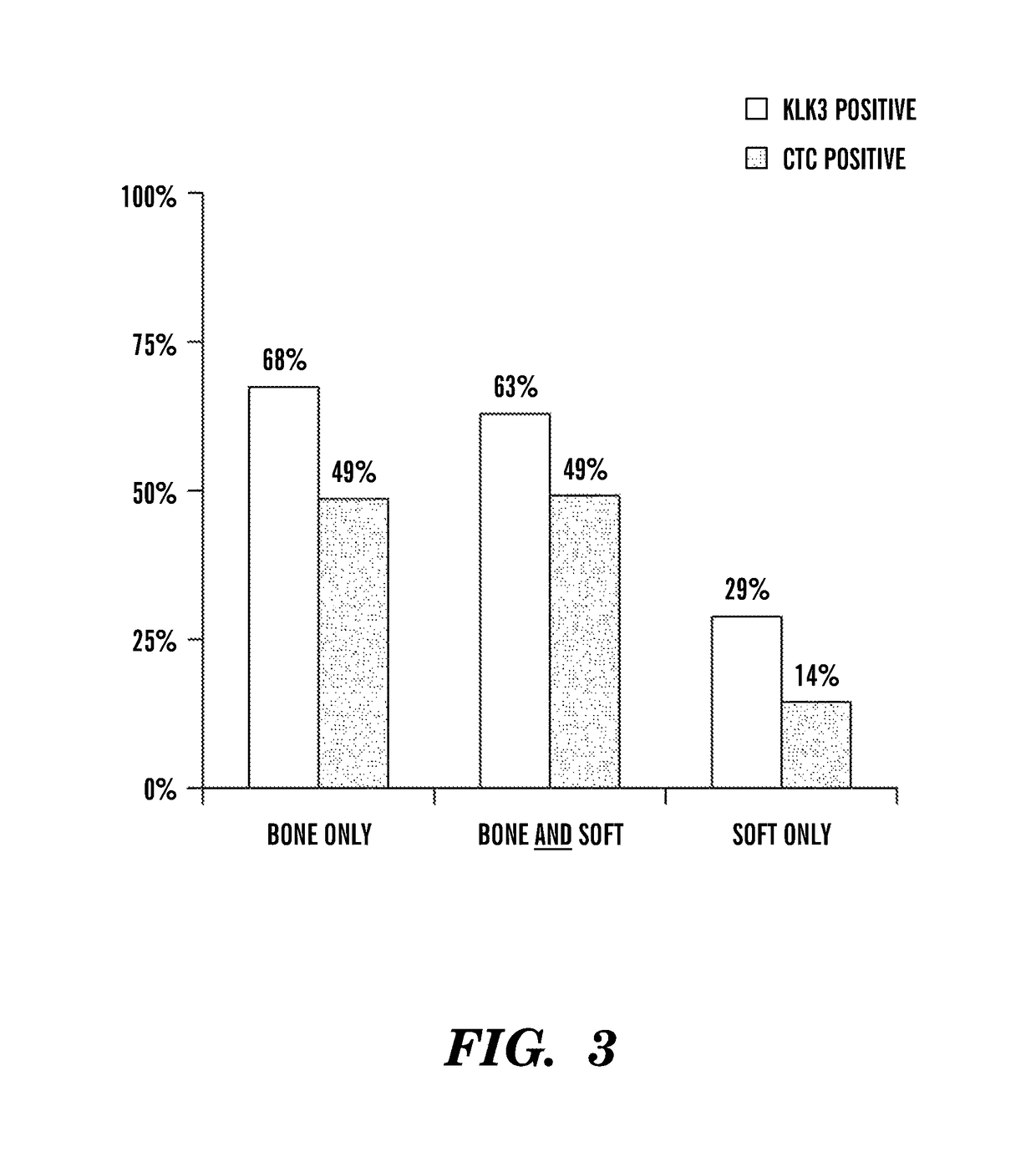 Gene expression profile associated with prostate cancer