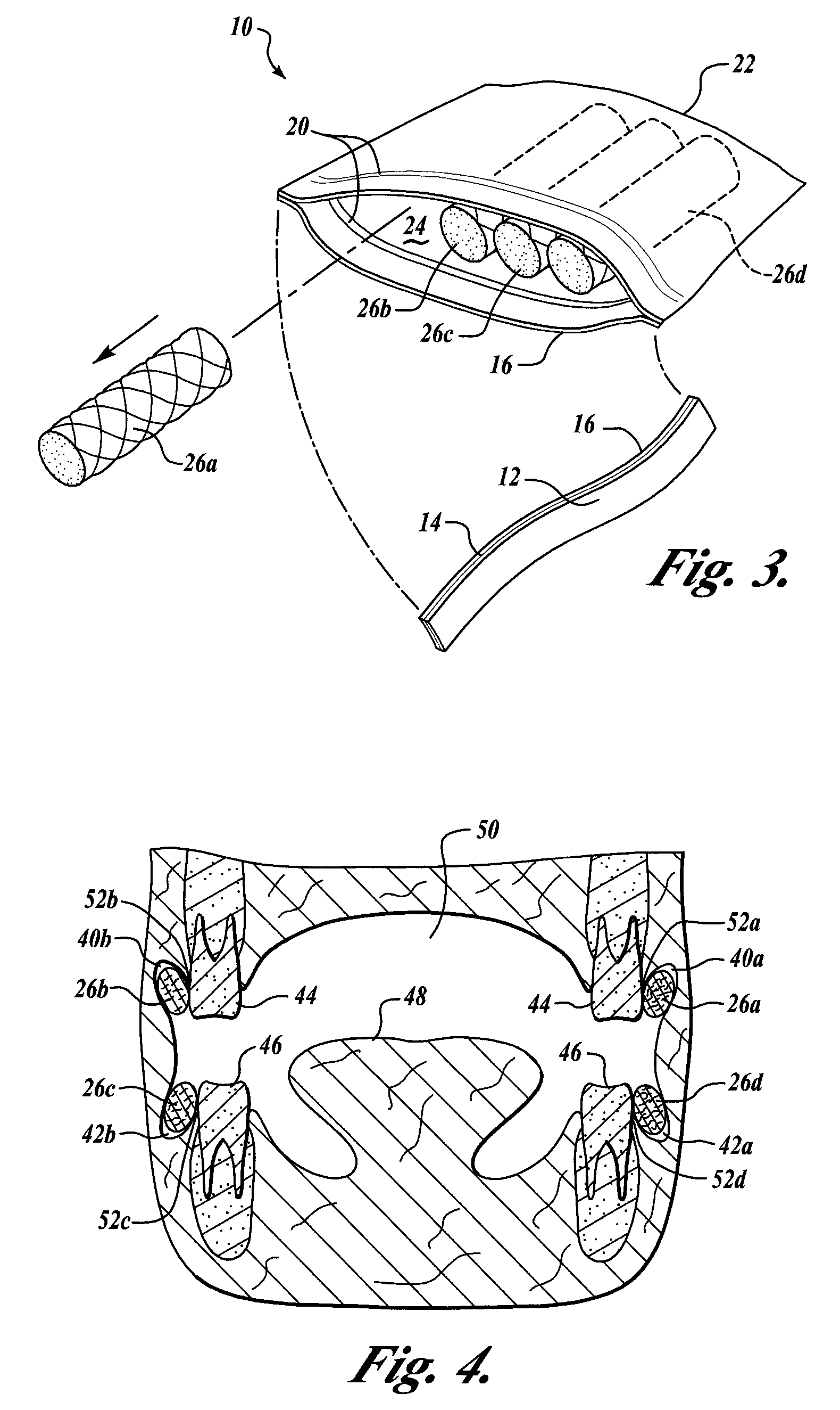 Oral Hygiene System and Method of Treatment