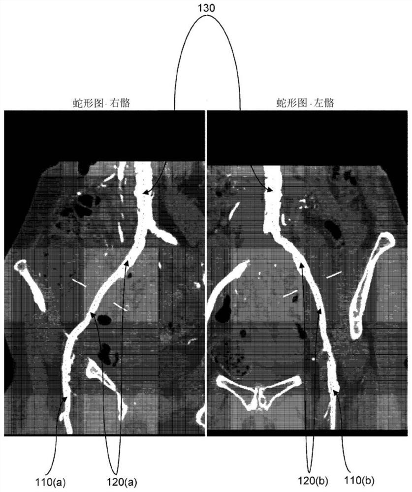 Adjustable sheath device