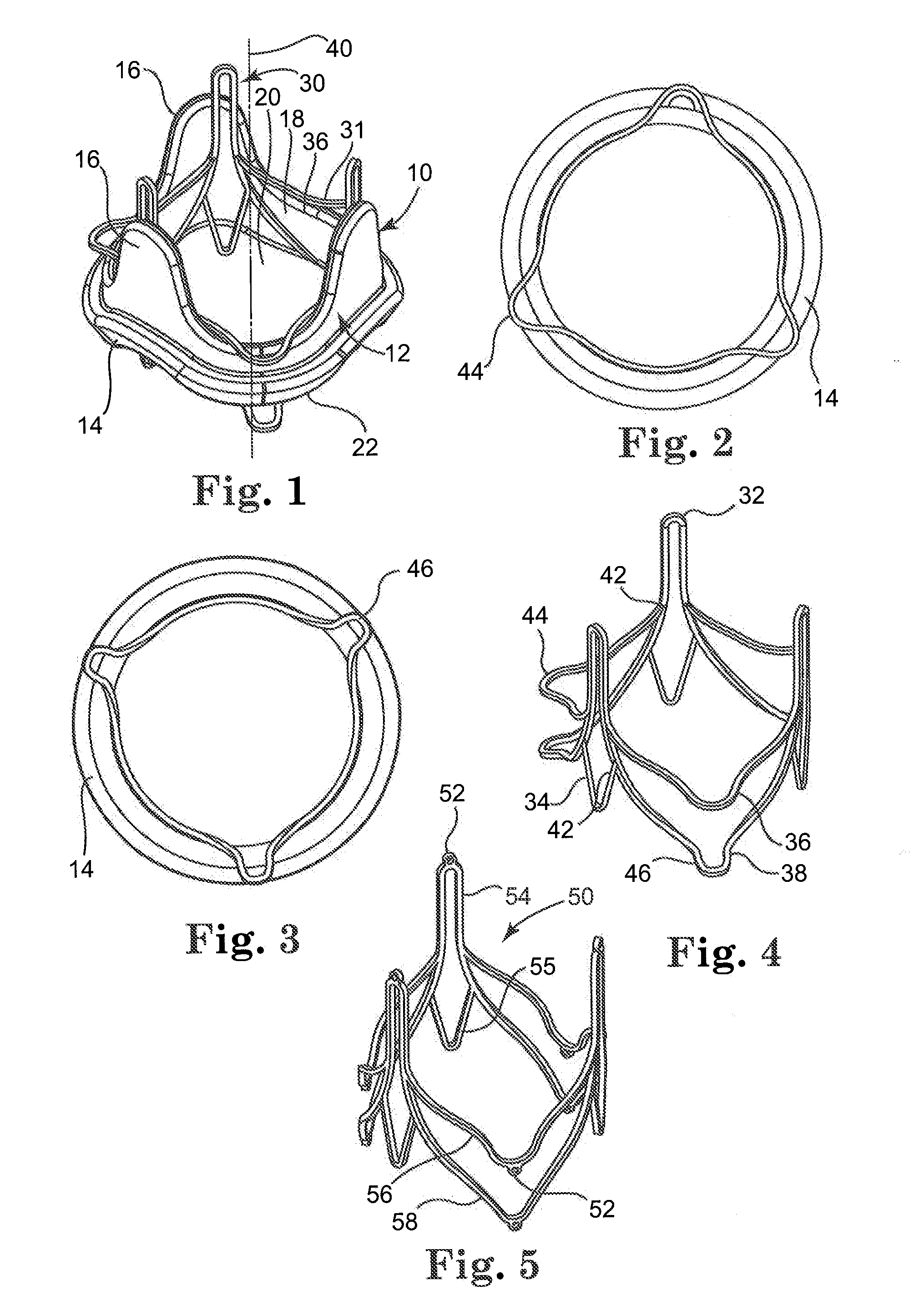 Replacement prosthetic heart valves and methods of implantation