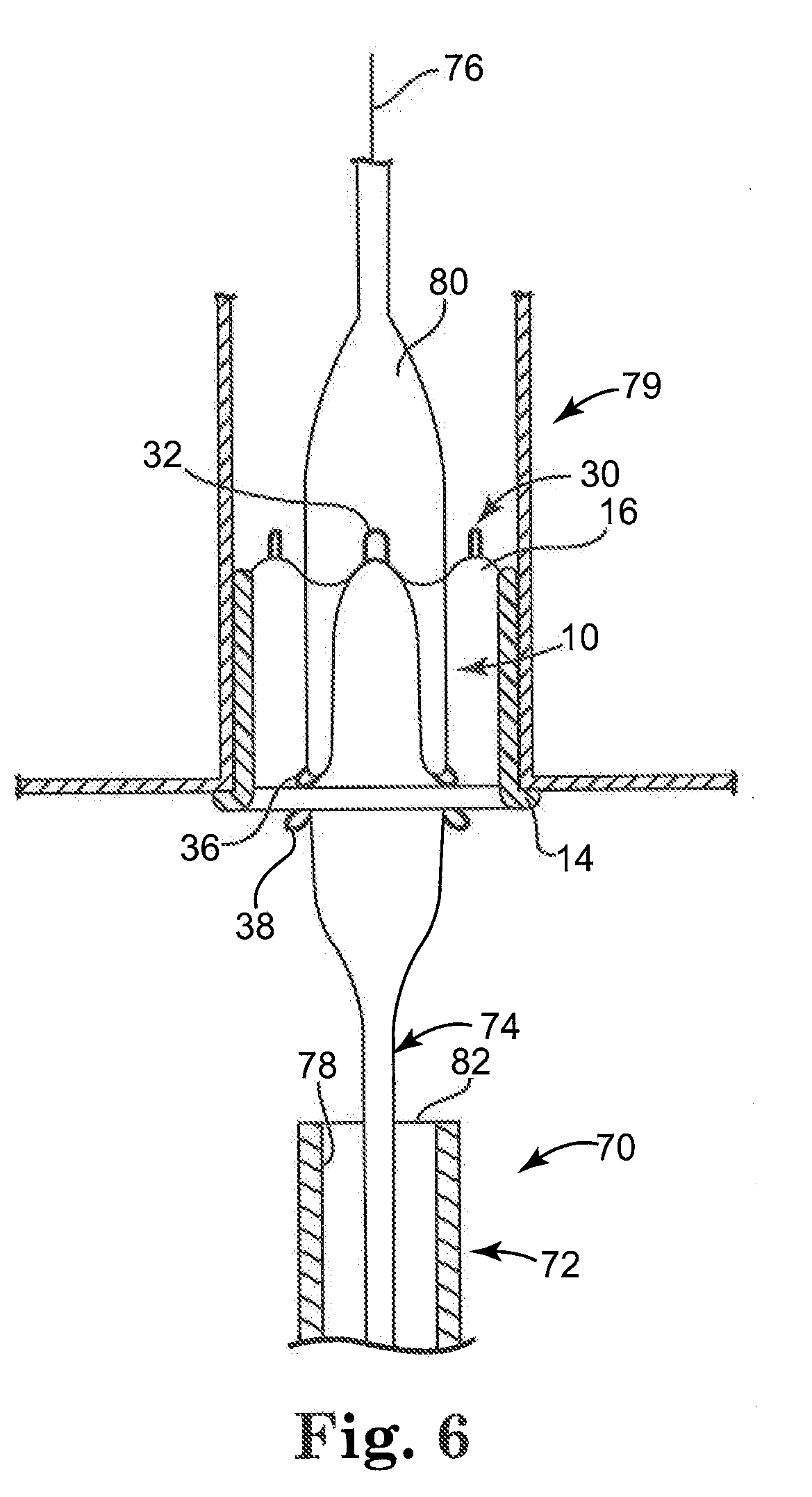 Replacement prosthetic heart valves and methods of implantation