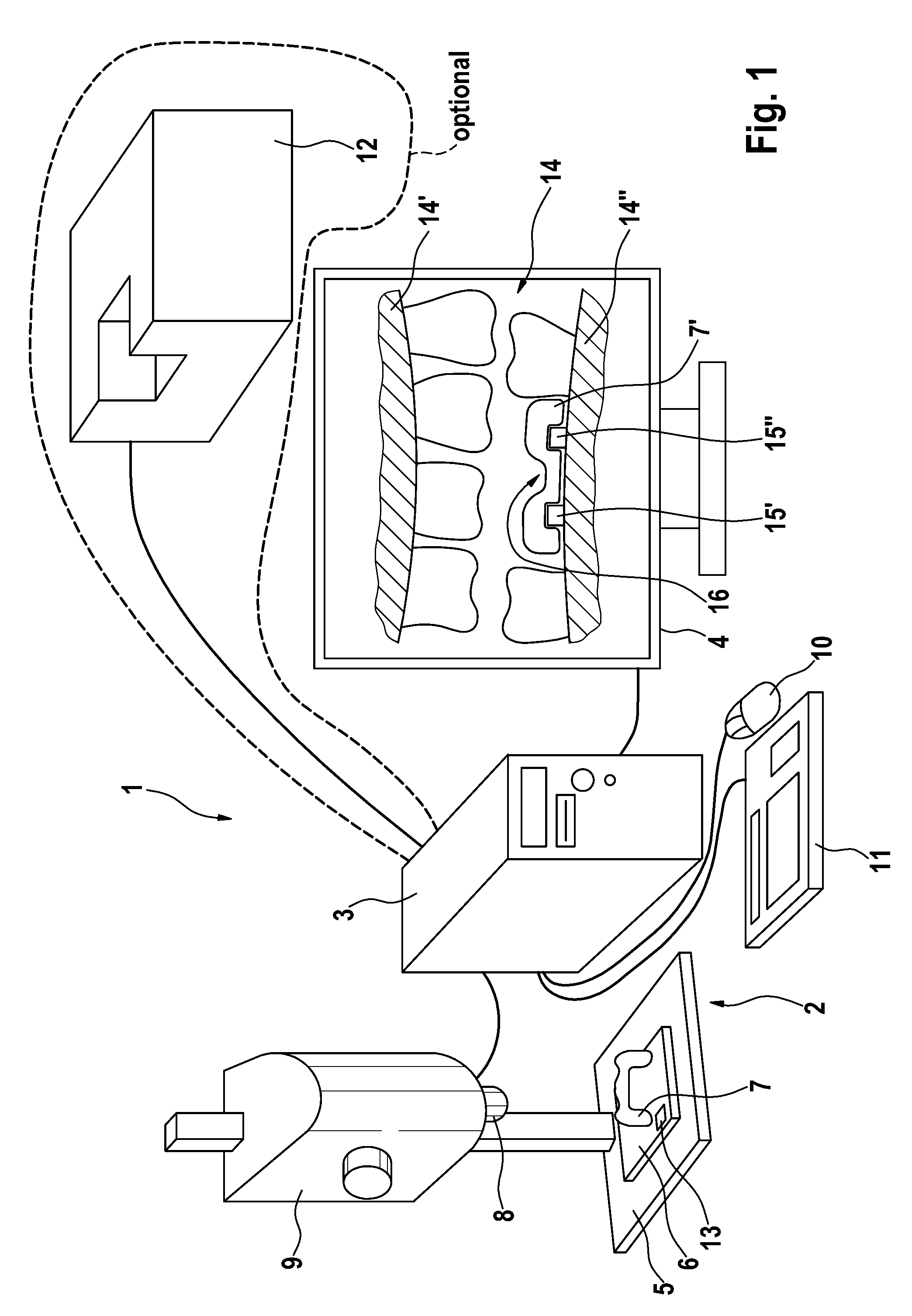 Method and device for producing dental prosthesis elements