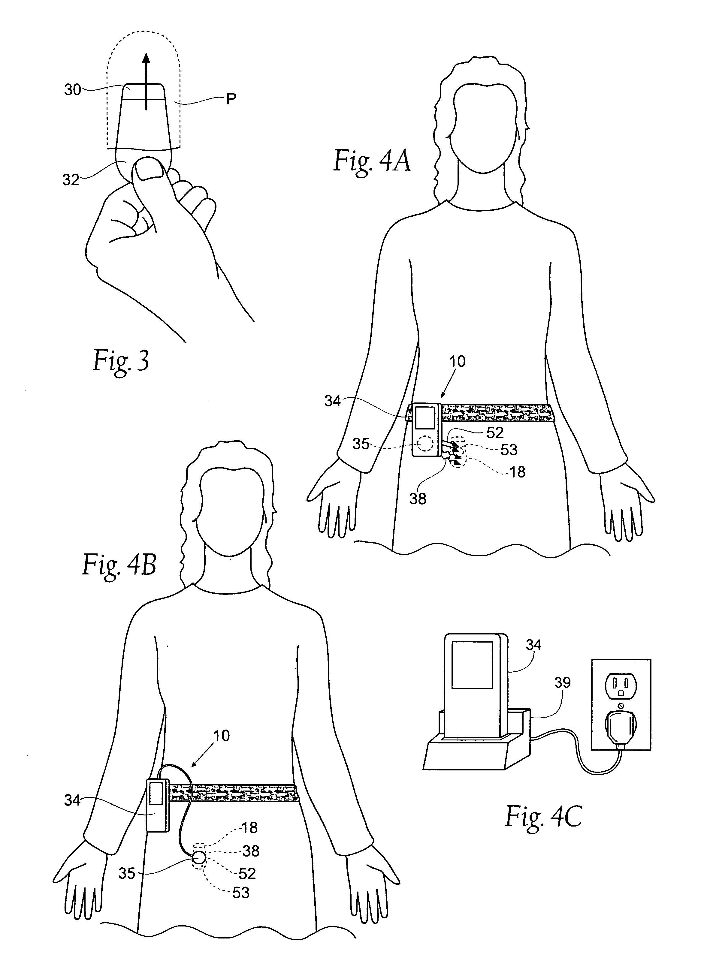 Implantable pulse generator for providing functional and/or therapeutic stimulation of muscles and /or nerves and/or central nervous system tissue