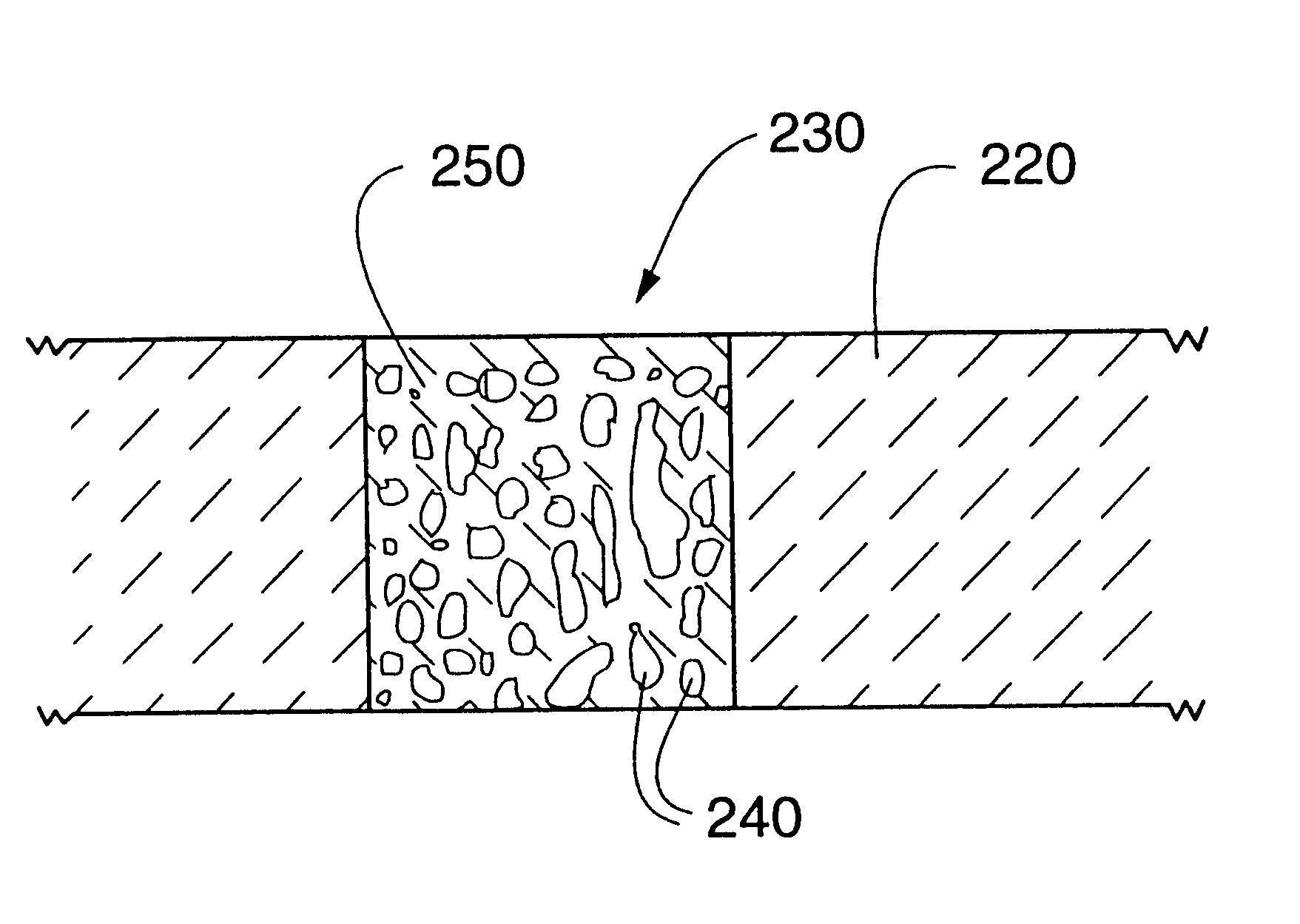 Electronic components incorporating ceramic-metal composites