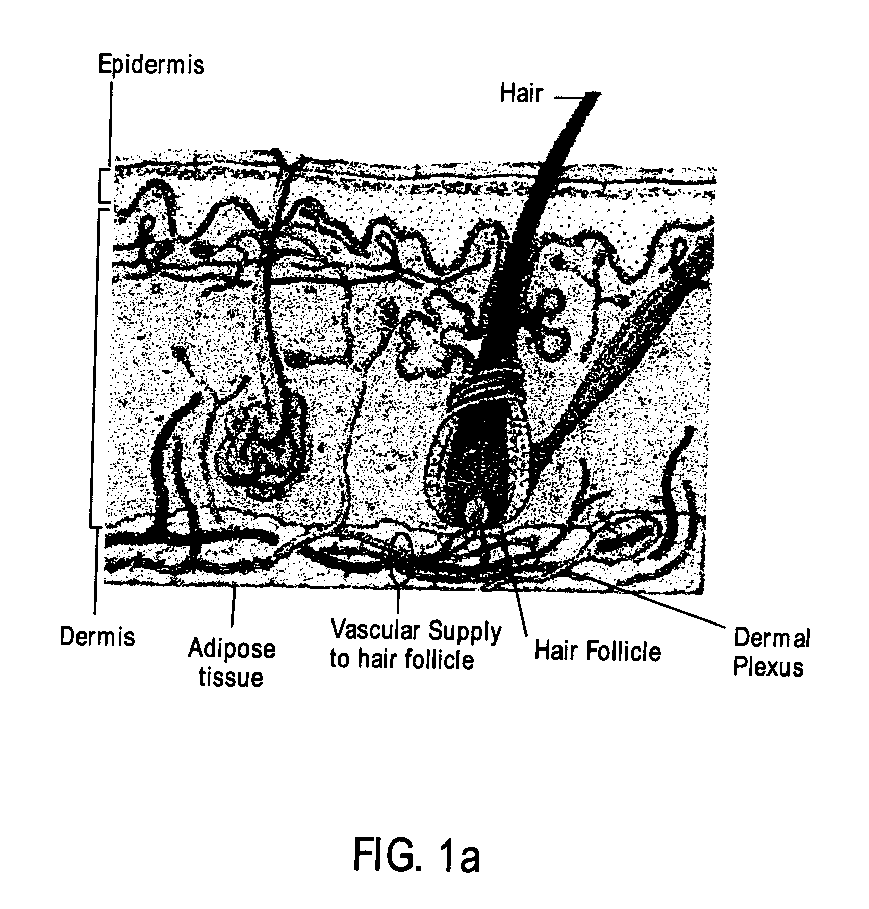 Apparatus and method having a cooling material and reduced pressure to treat biological external tissue