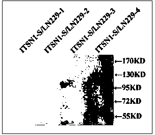 Antigen protein of anti-bridge molecule 1-s antibody, and rabbit polyclonal antibody and application thereof