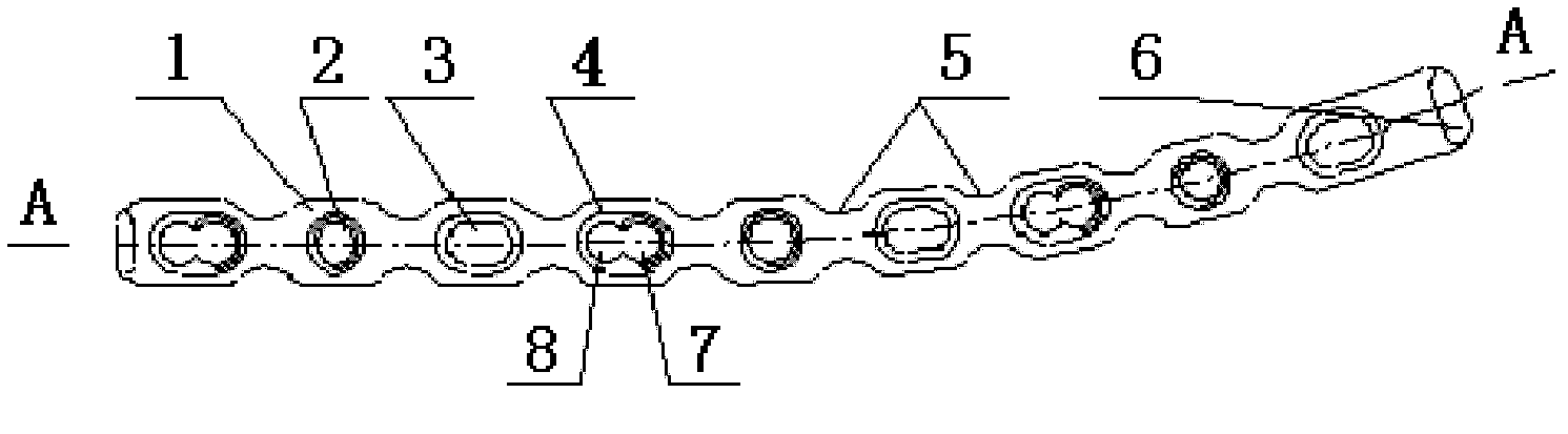 Locking pressurizing bone fracture plate placed on front lower portion of clavicle of human body