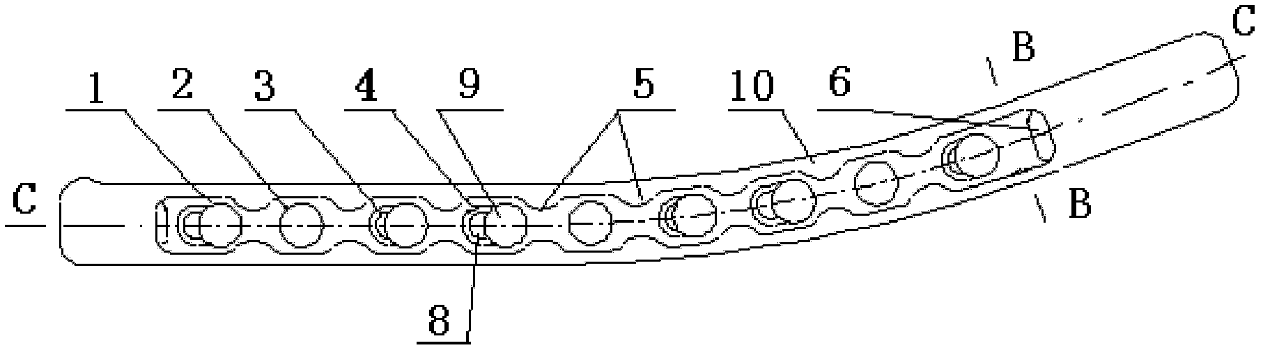 Locking pressurizing bone fracture plate placed on front lower portion of clavicle of human body