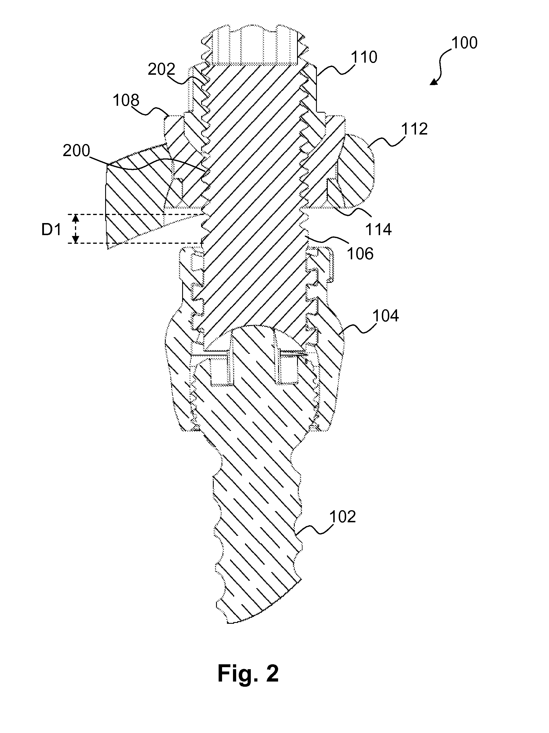 System and method for a spinal implant locking assembly