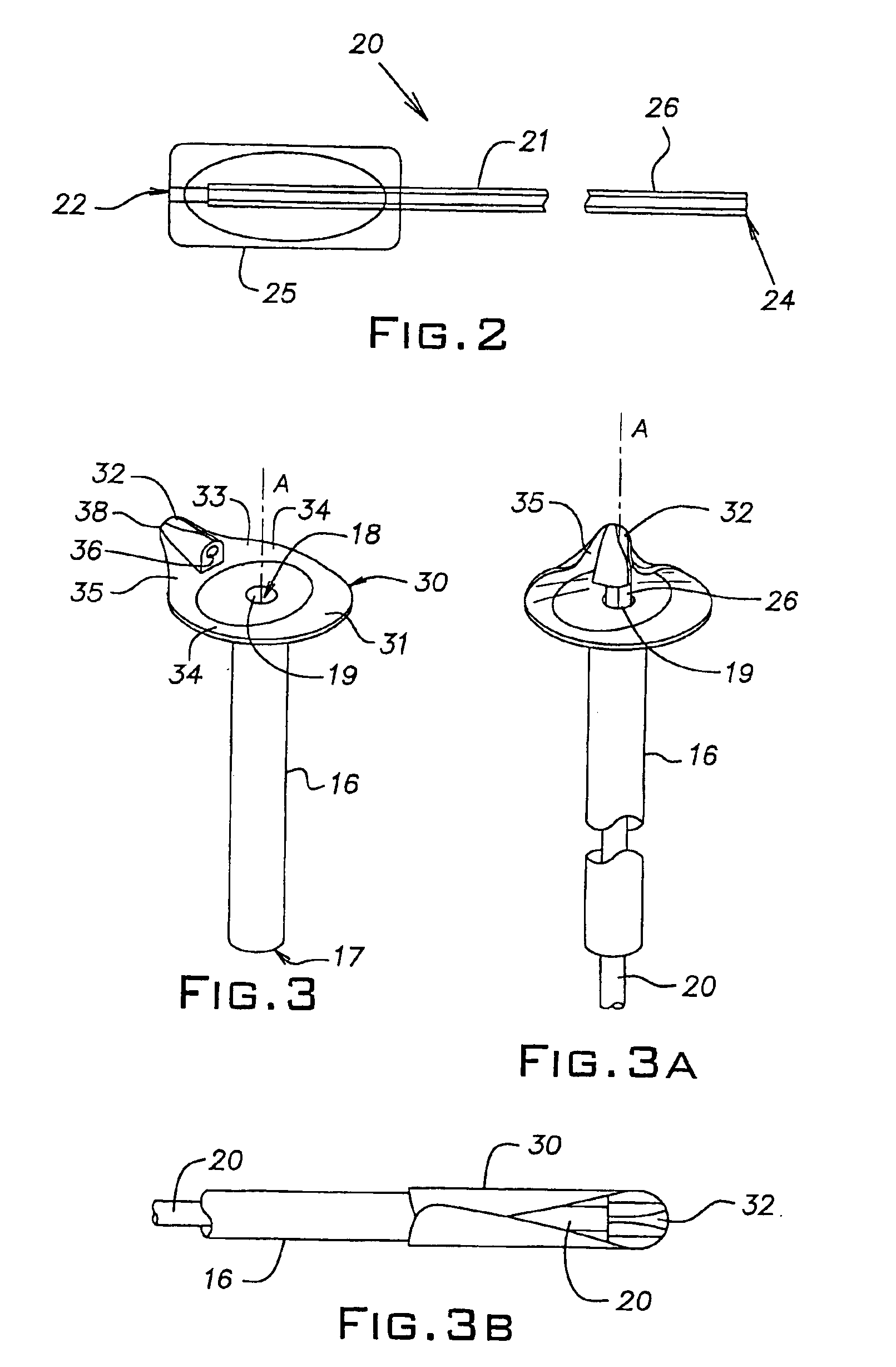 Gastrostomy device package and method of assembly